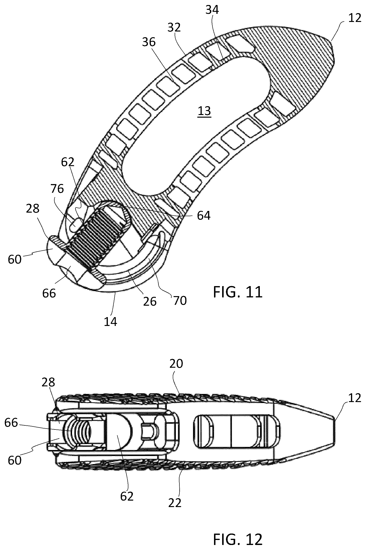 Patent US12090060 Figure 5 – Inter vertebral spinal implant