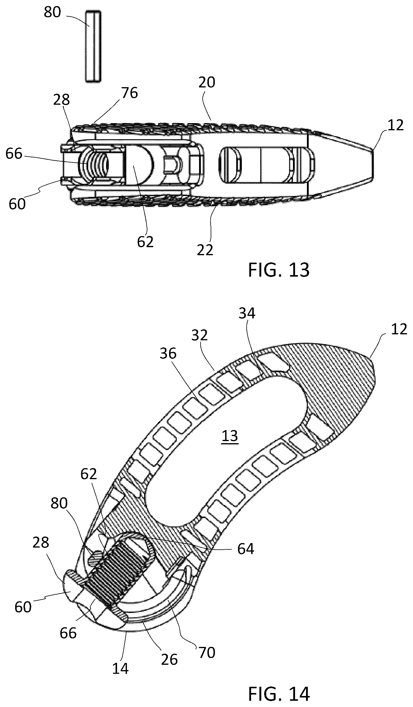 Patent US12090060 Figure 6 – Inter vertebral spinal implant