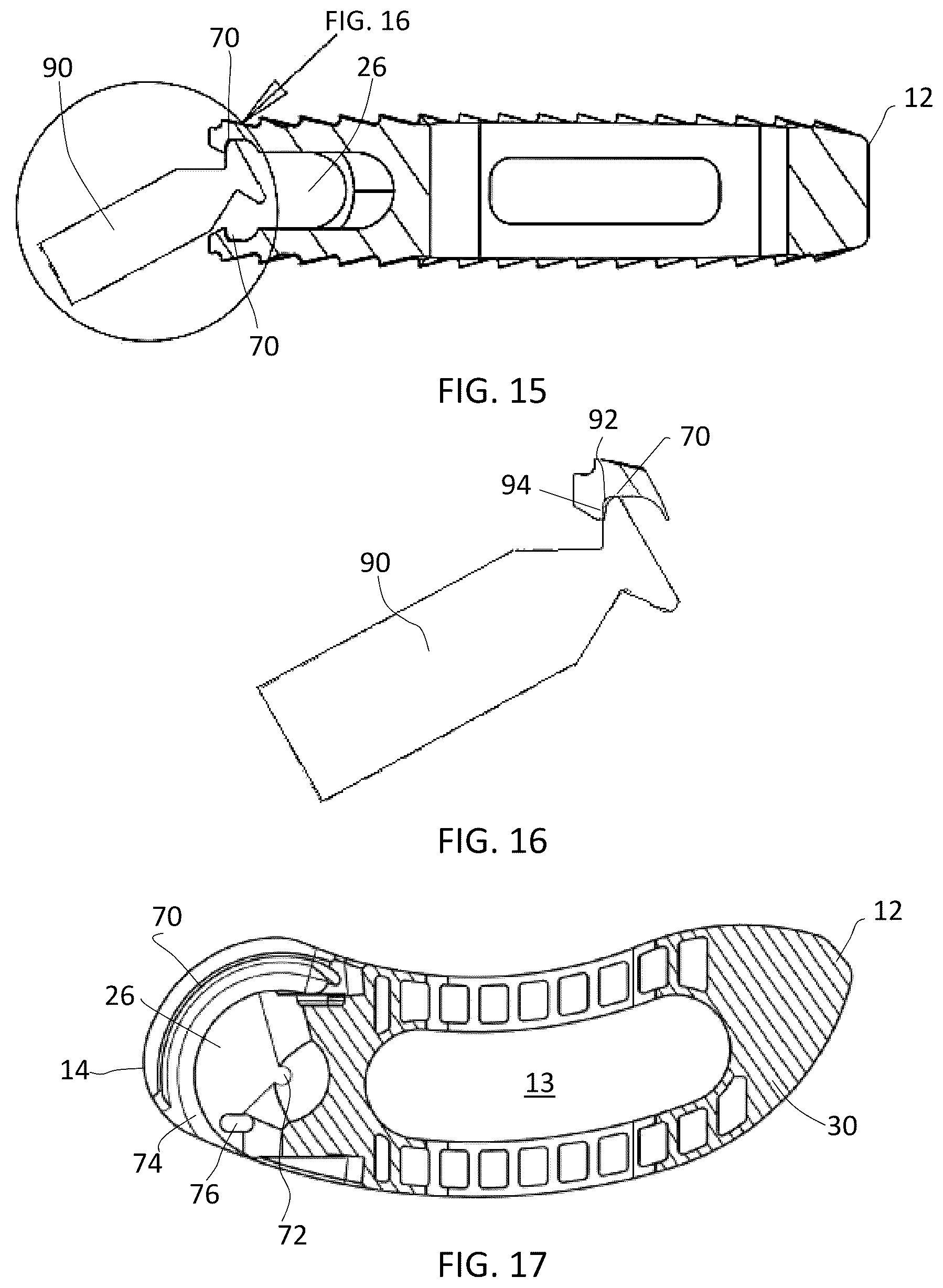 Patent US12090060 Figure 7 – Inter vertebral spinal implant