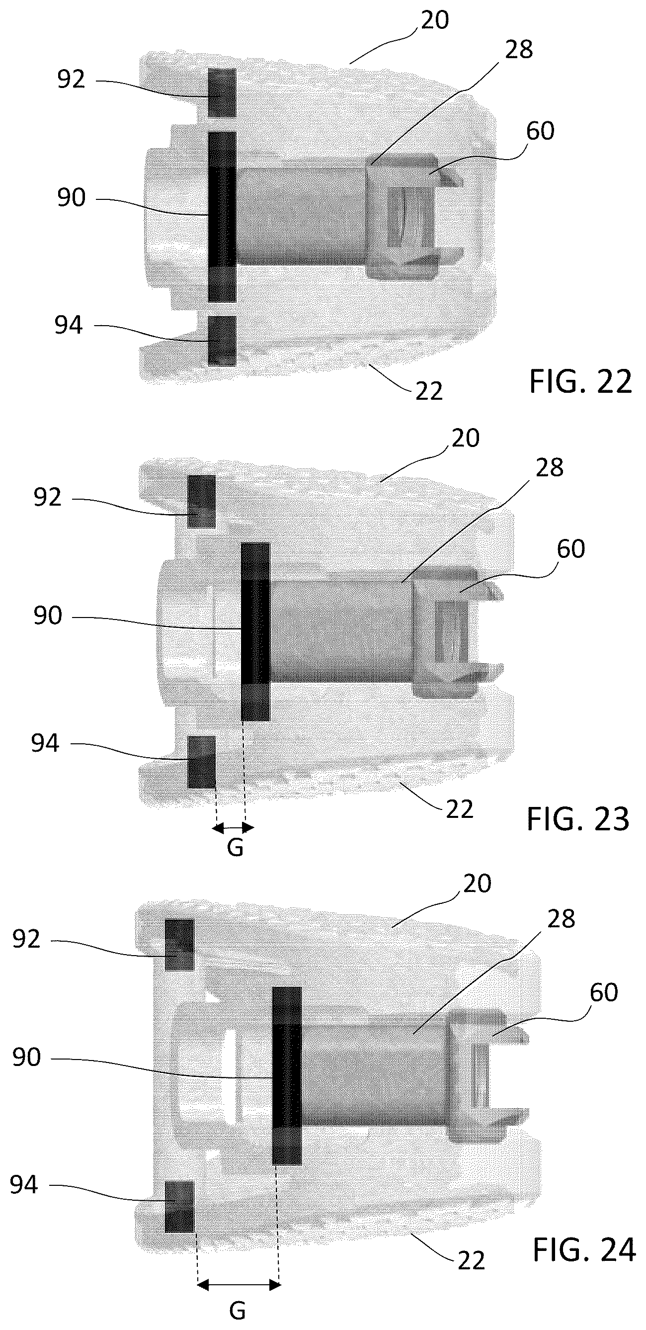 Patent US12090060 Figure 9 – Inter vertebral spinal implant