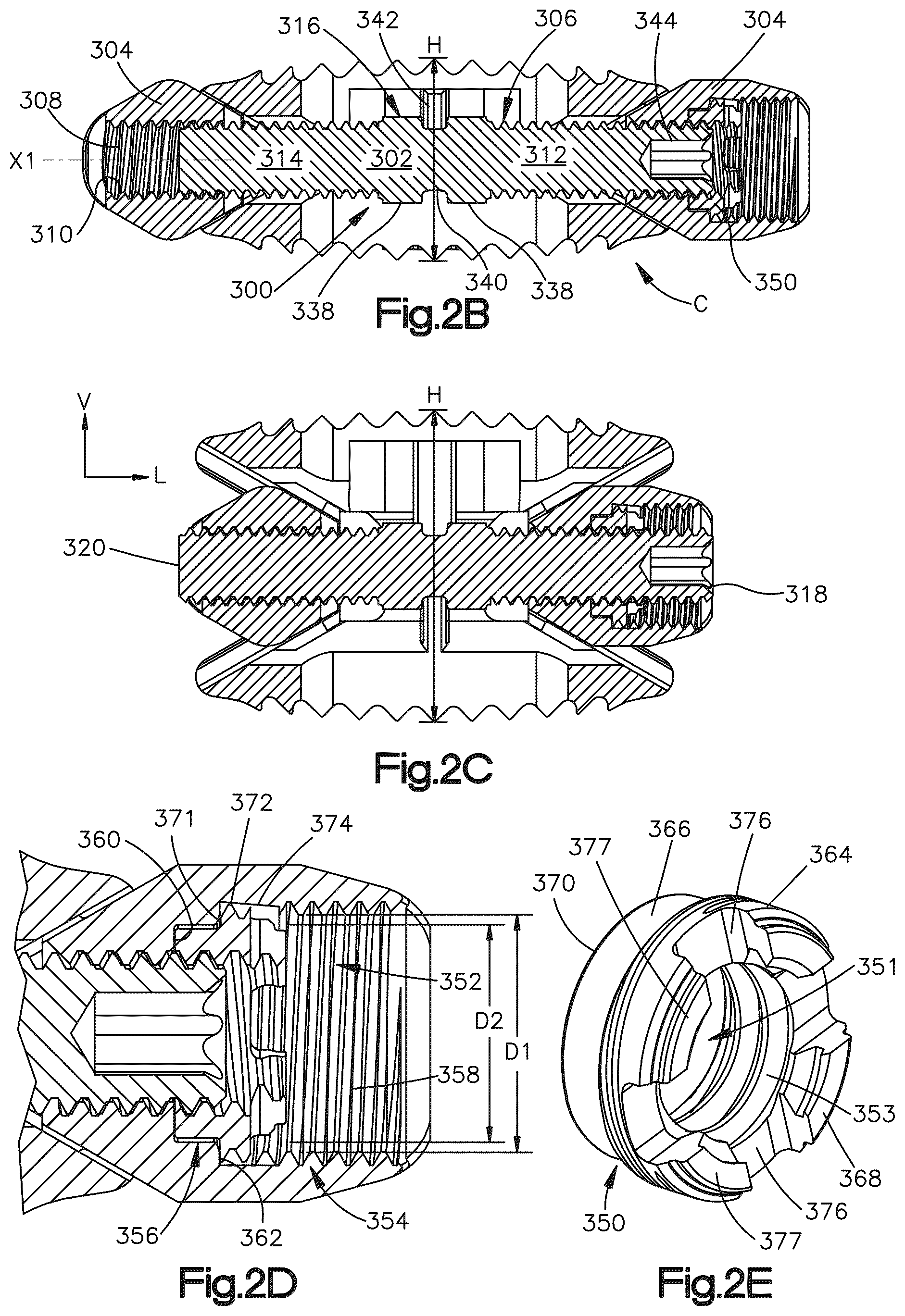 Patent US12090064 Figure 2 – Stabilization members for expandable intervertebral implants, and related systems and methods