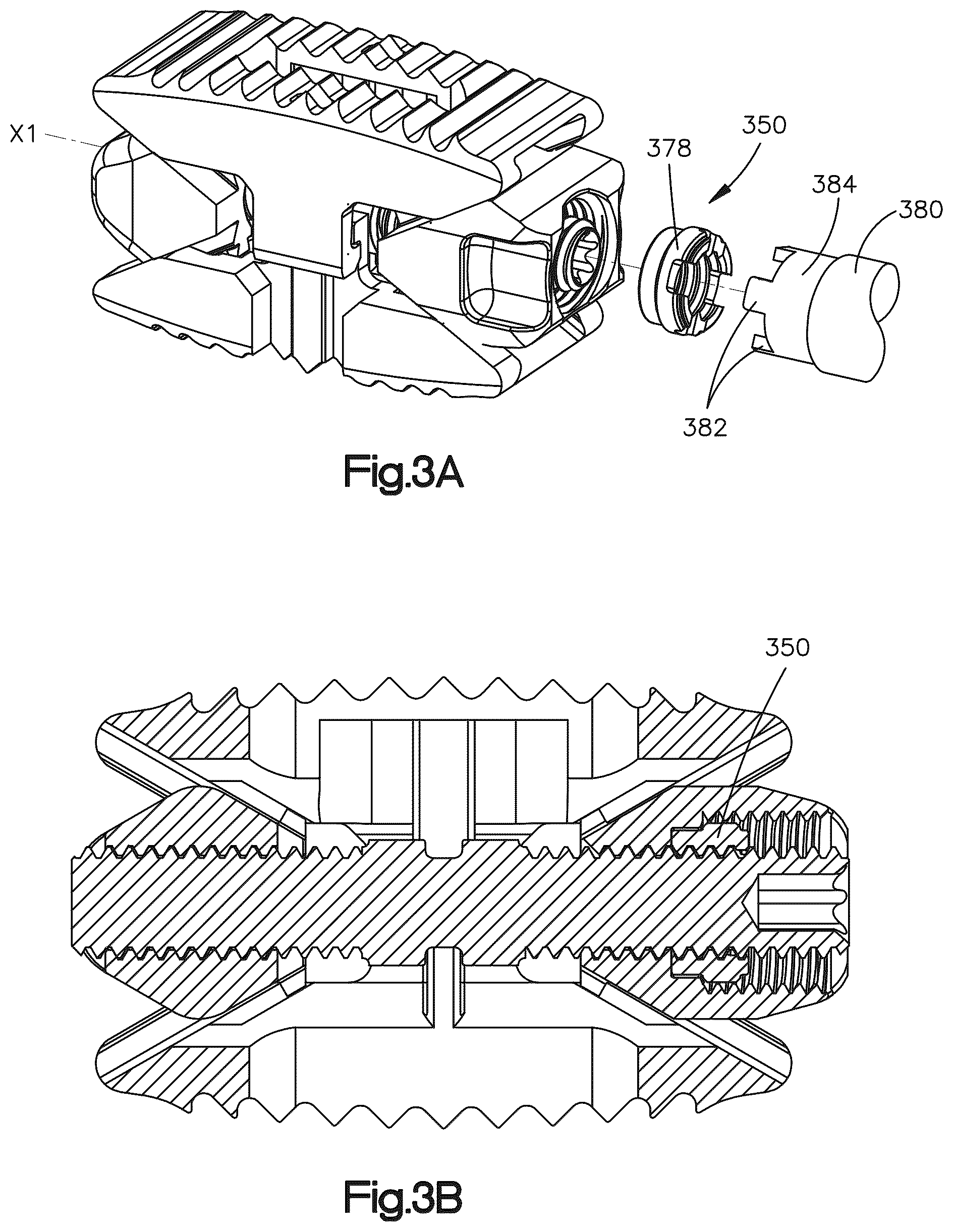 Patent US12090064 Figure 3 – Stabilization members for expandable intervertebral implants, and related systems and methods