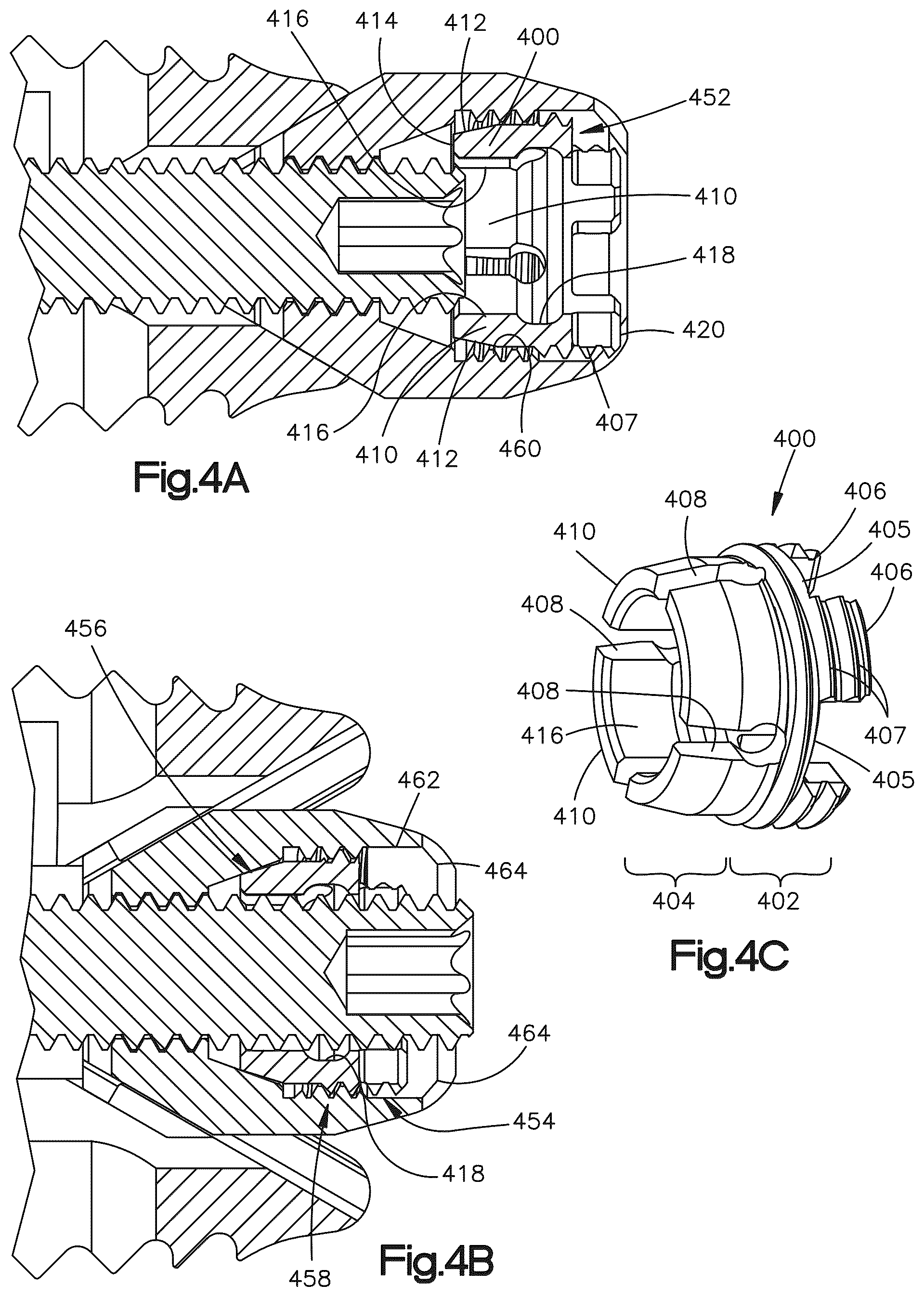 Patent US12090064 Figure 4 – Stabilization members for expandable intervertebral implants, and related systems and methods