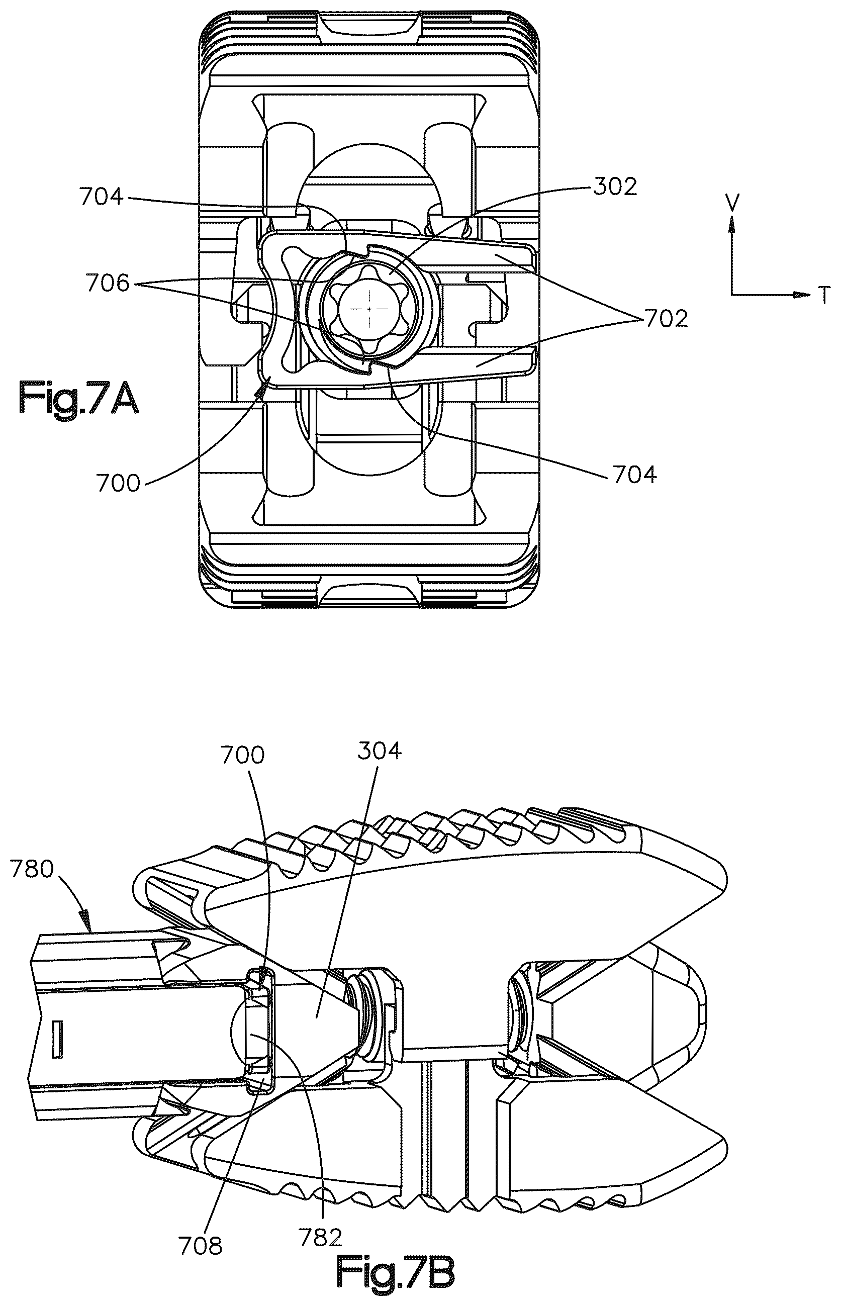 Patent US12090064 Figure 9 – Stabilization members for expandable intervertebral implants, and related systems and methods
