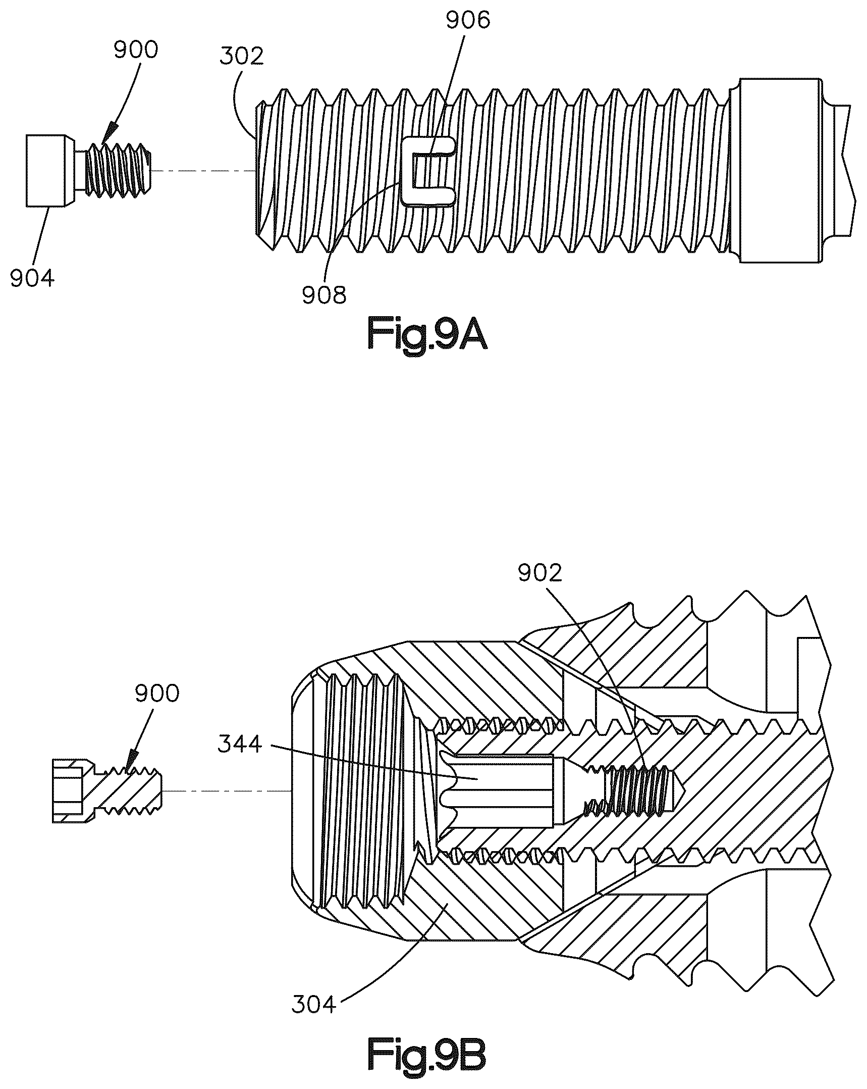 Patent US12090064 Figure 11 – Stabilization members for expandable intervertebral implants, and related systems and methods
