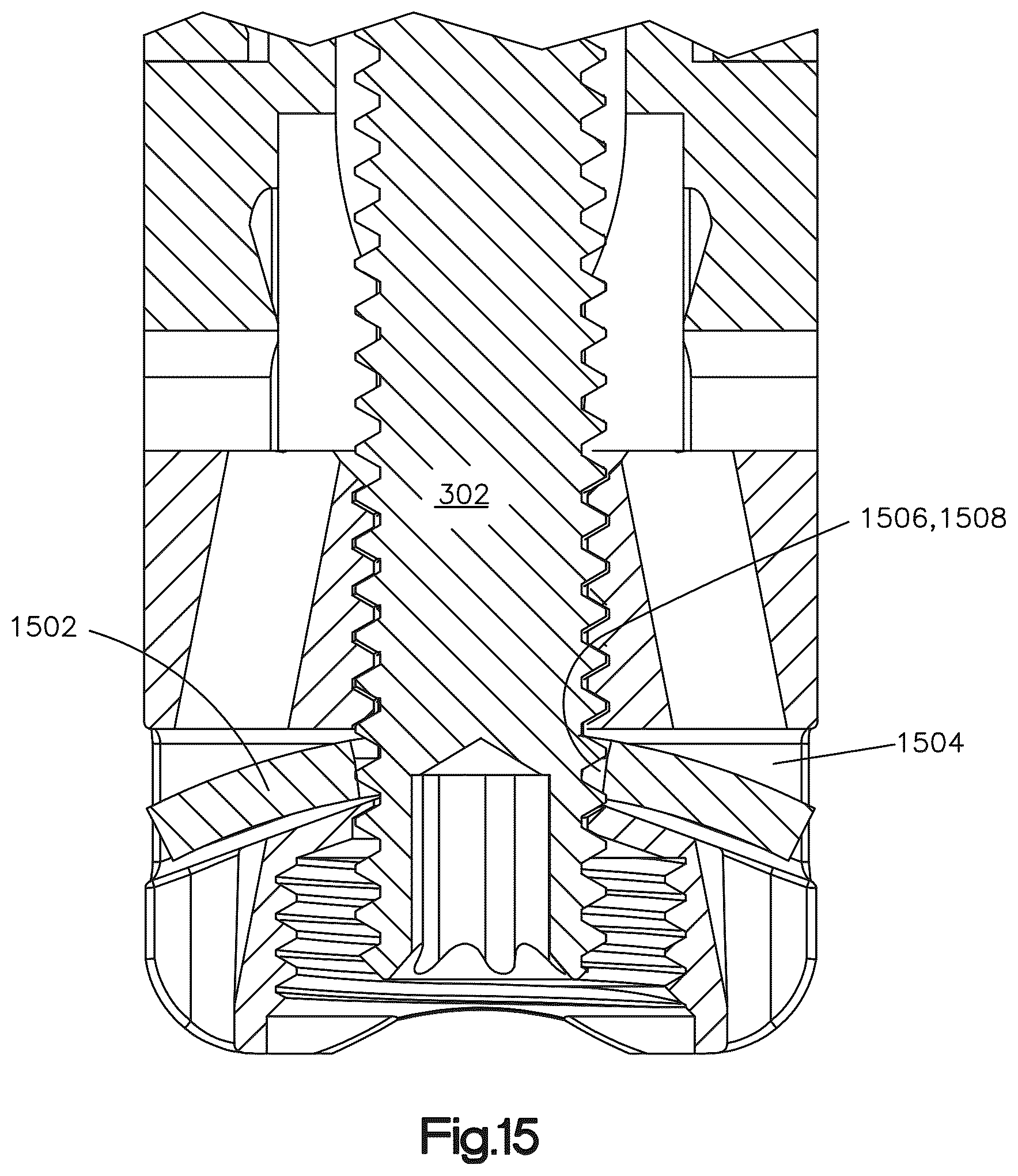 Patent US12090064 Figure 16 – Stabilization members for expandable intervertebral implants, and related systems and methods