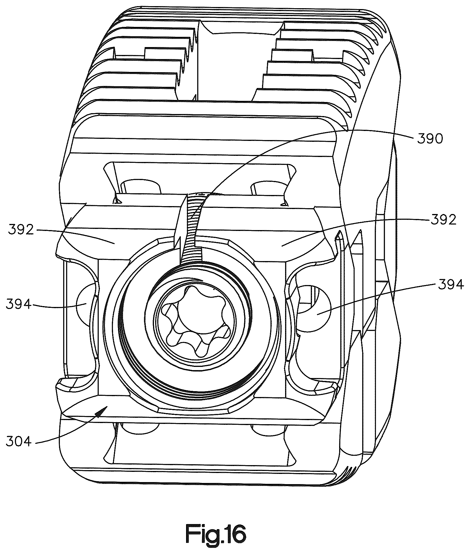 Patent US12090064 Figure 17 – Stabilization members for expandable intervertebral implants, and related systems and methods