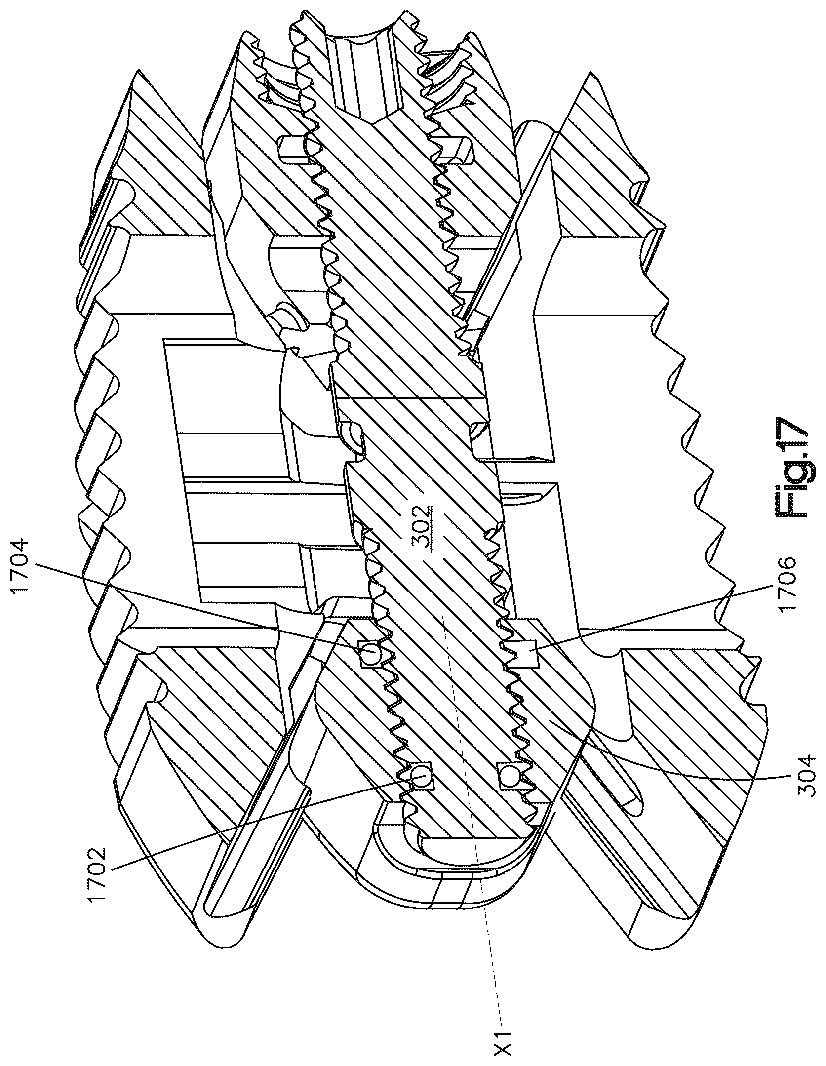 Patent US12090064 Figure 18 – Stabilization members for expandable intervertebral implants, and related systems and methods