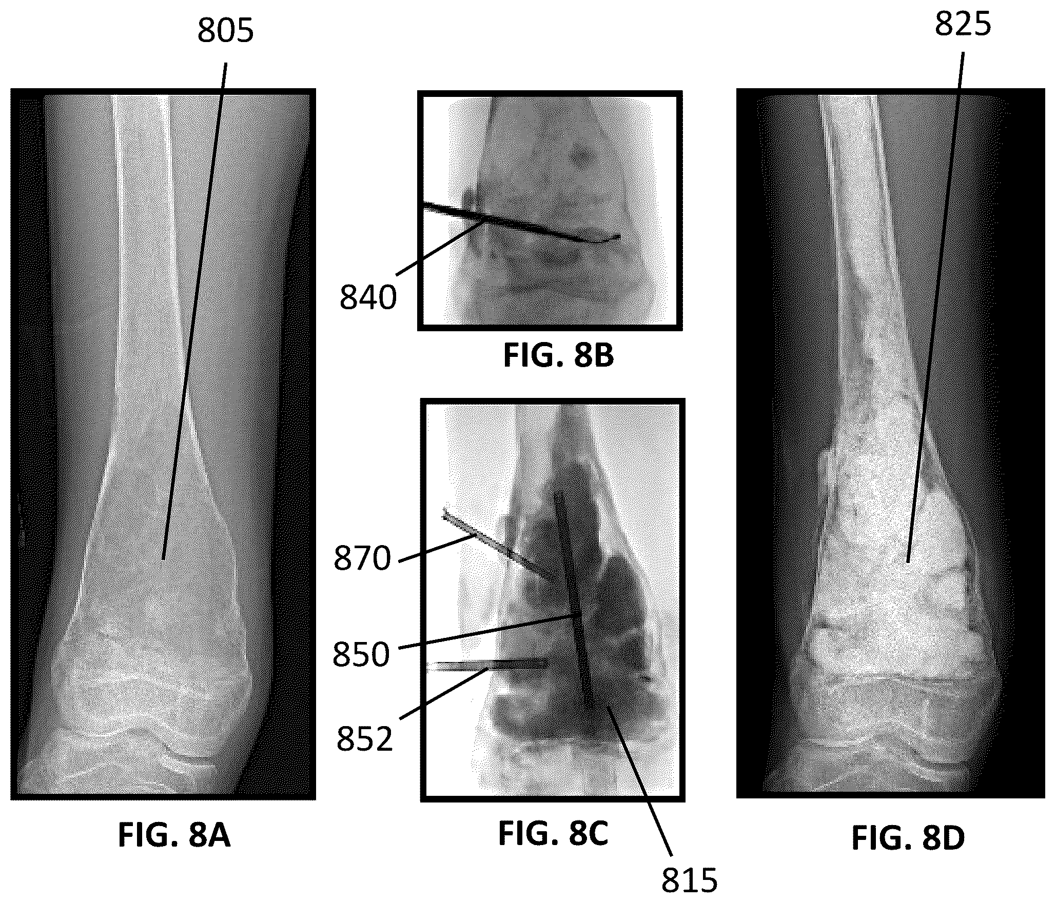 Patent US12090065 Figure 8 – System and method for treatment of bone