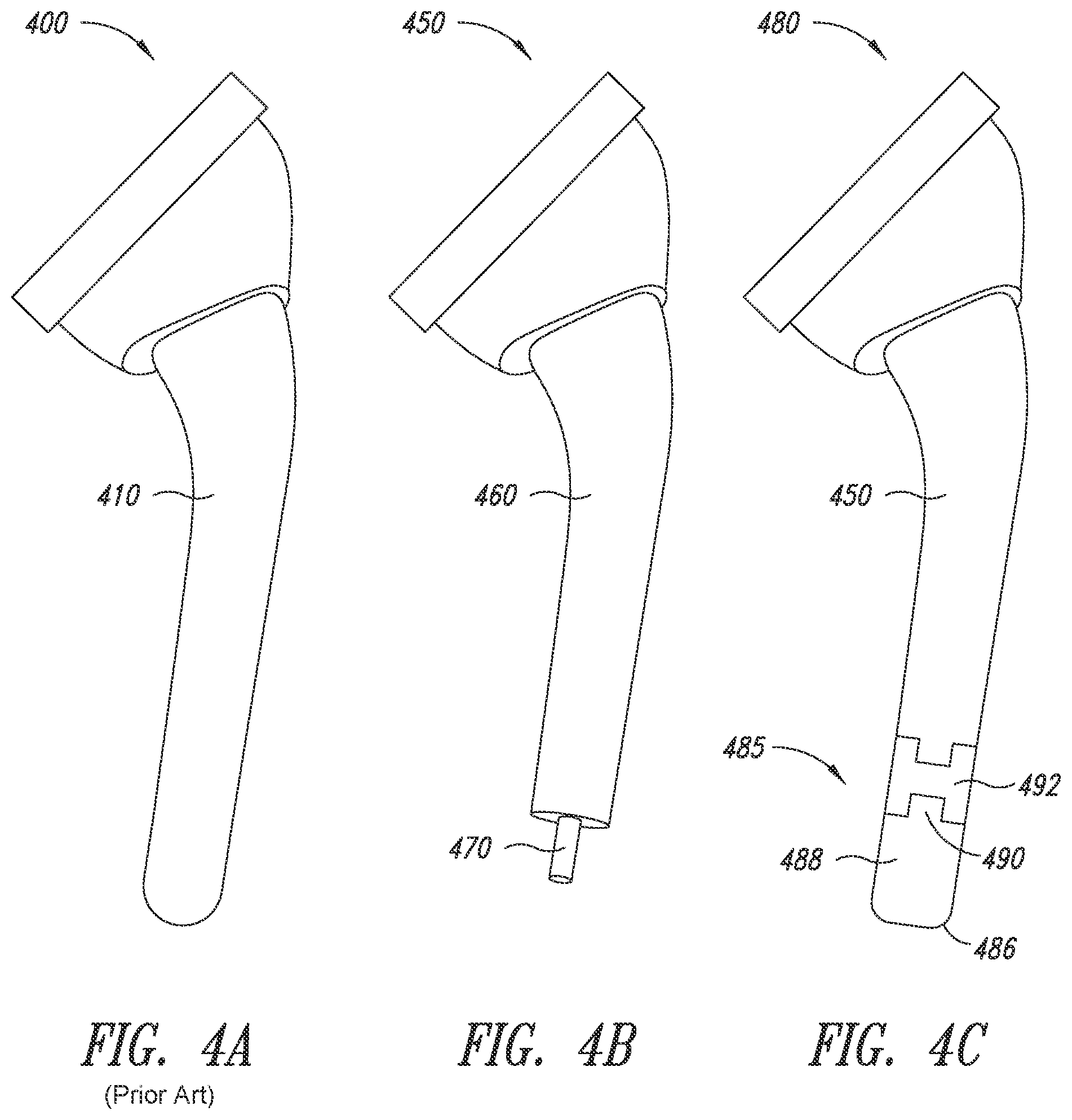 Patent US12090066 Figure 4 – Multi-piece implantable joint prosthesis