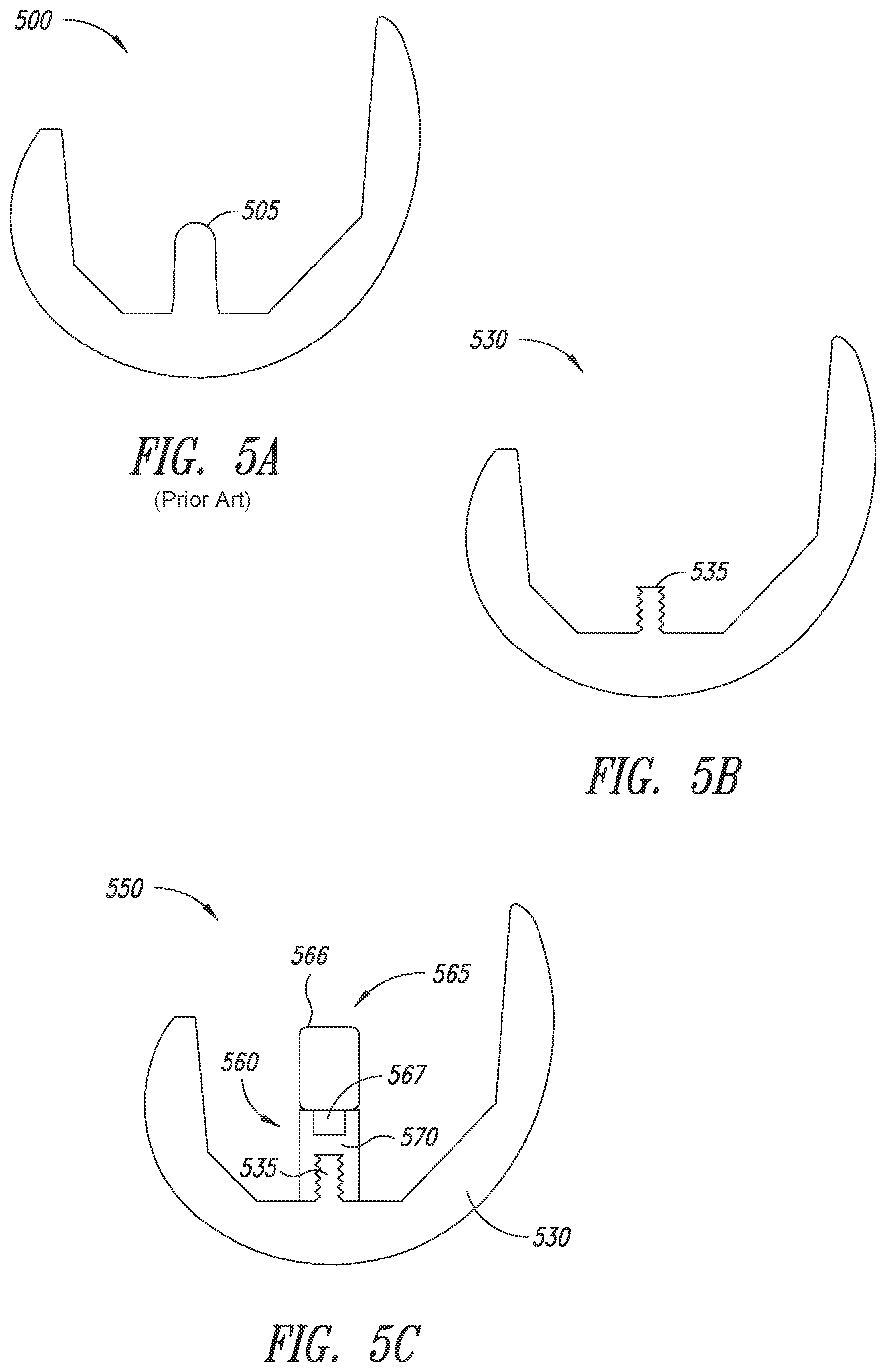 Patent US12090066 Figure 5 – Multi-piece implantable joint prosthesis