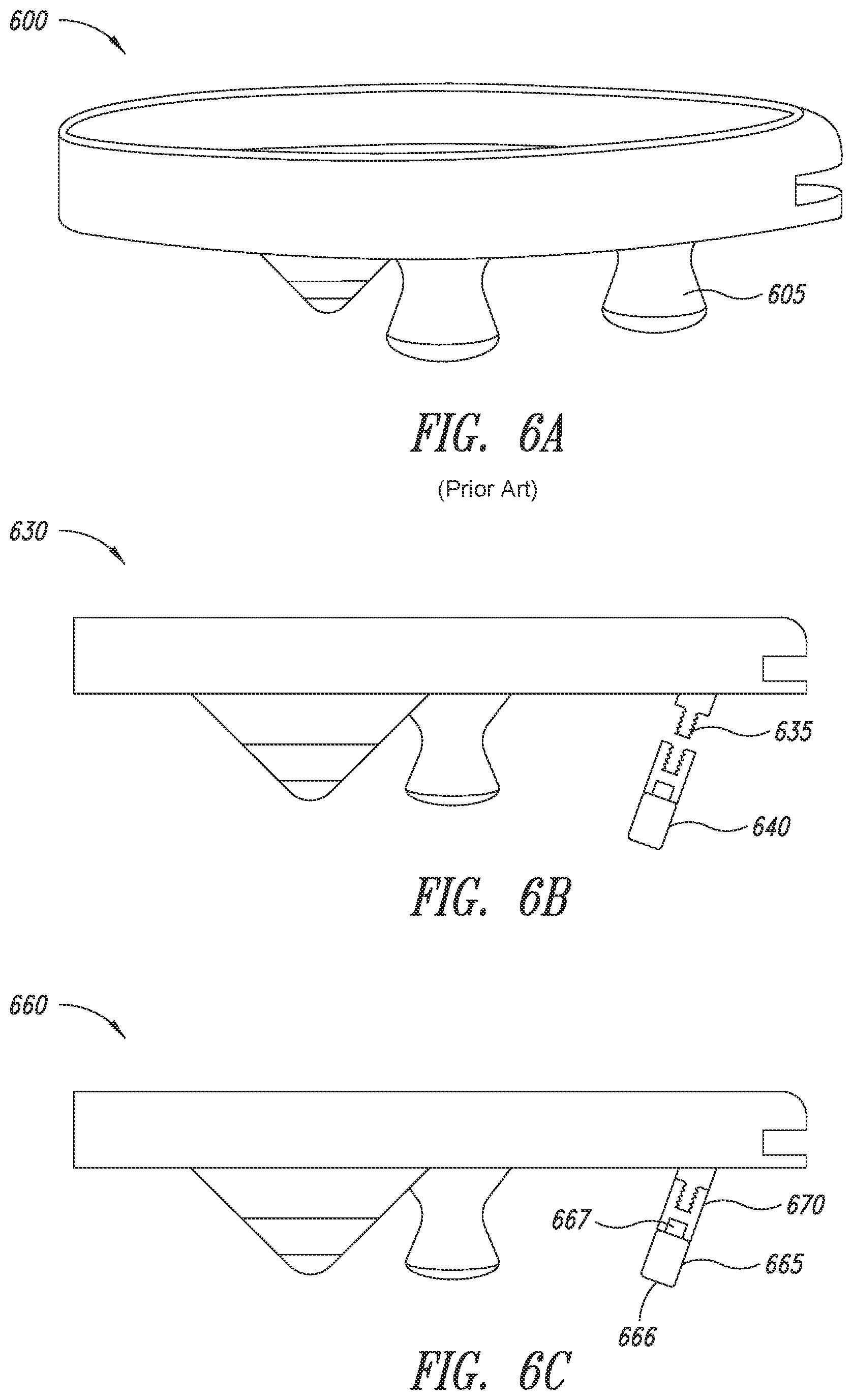 Patent US12090066 Figure 6 – Multi-piece implantable joint prosthesis