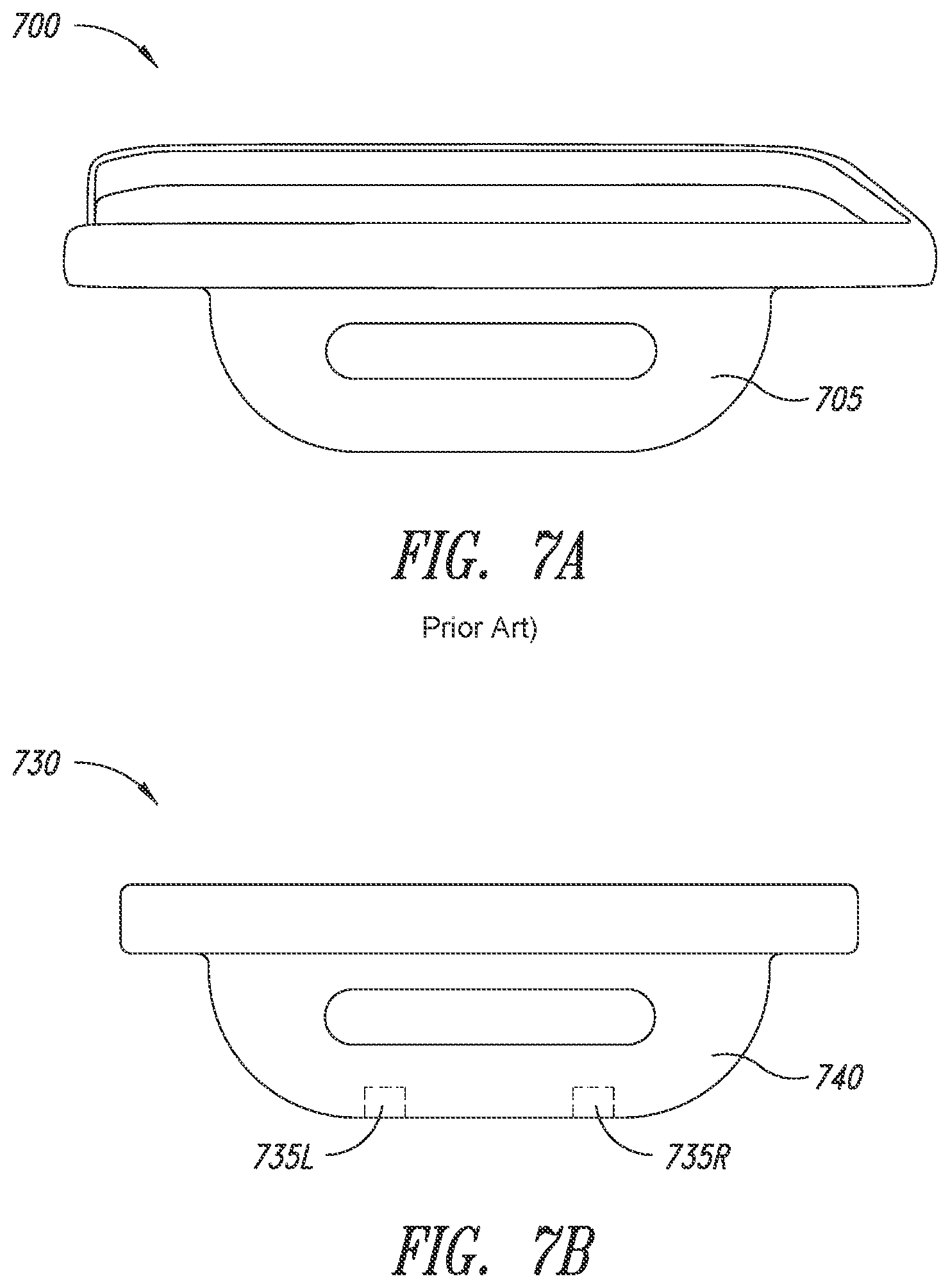 Patent US12090066 Figure 7 – Multi-piece implantable joint prosthesis