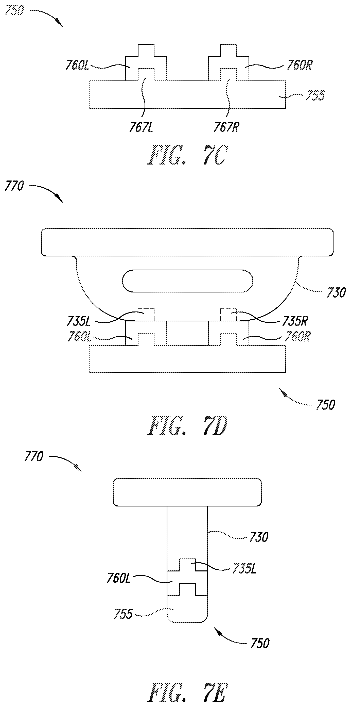 Patent US12090066 Figure 8 – Multi-piece implantable joint prosthesis