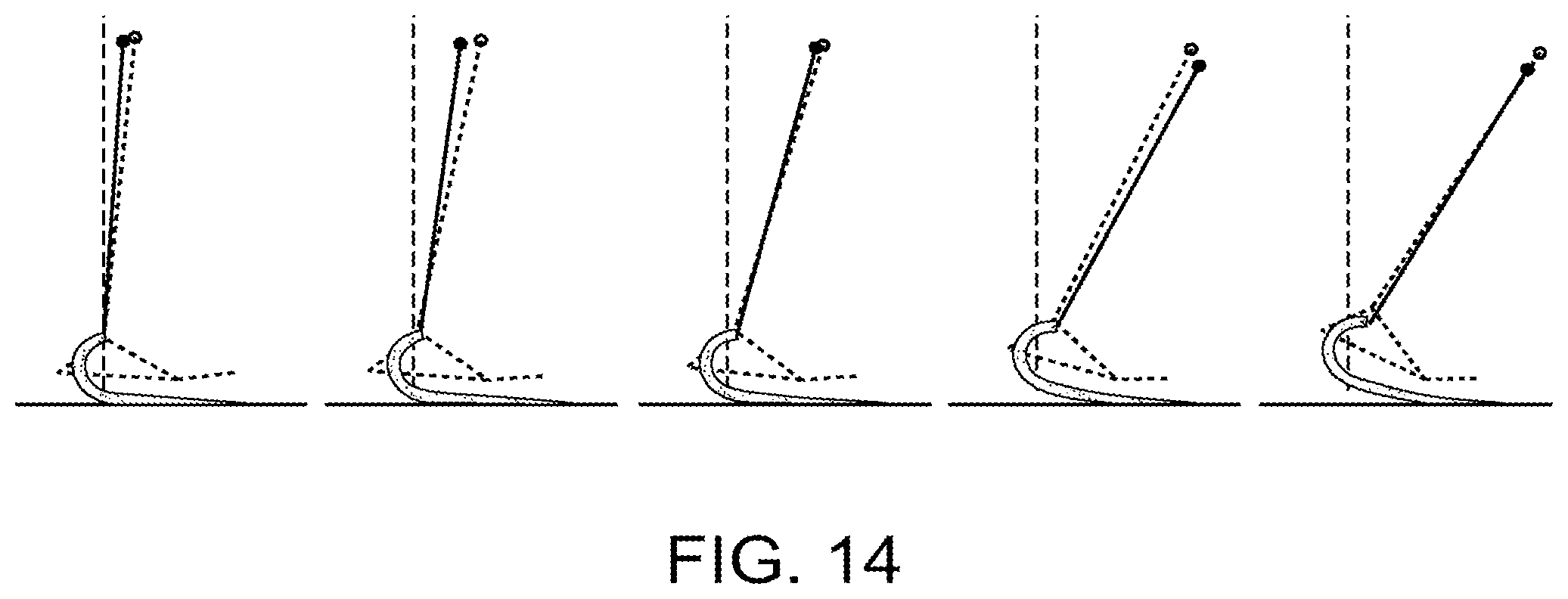 Patent US12090067 Figure 12 – Method for design and manufacture of compliant prosthetic foot