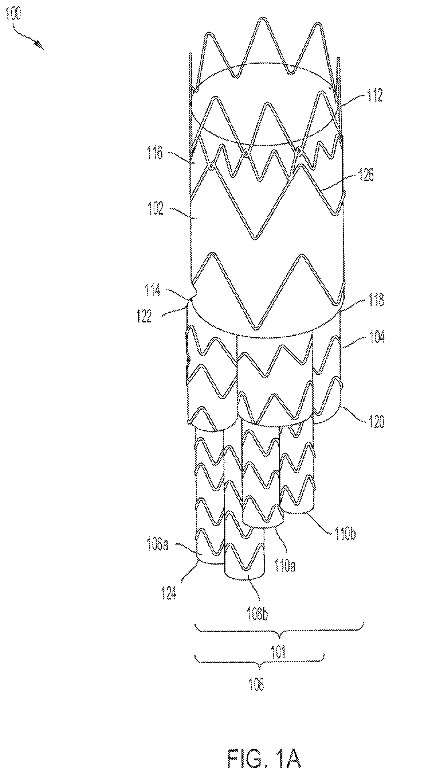 Patent US12090070 Figure 1 – Re-location of main body bypass branch on multi-branched stent graft