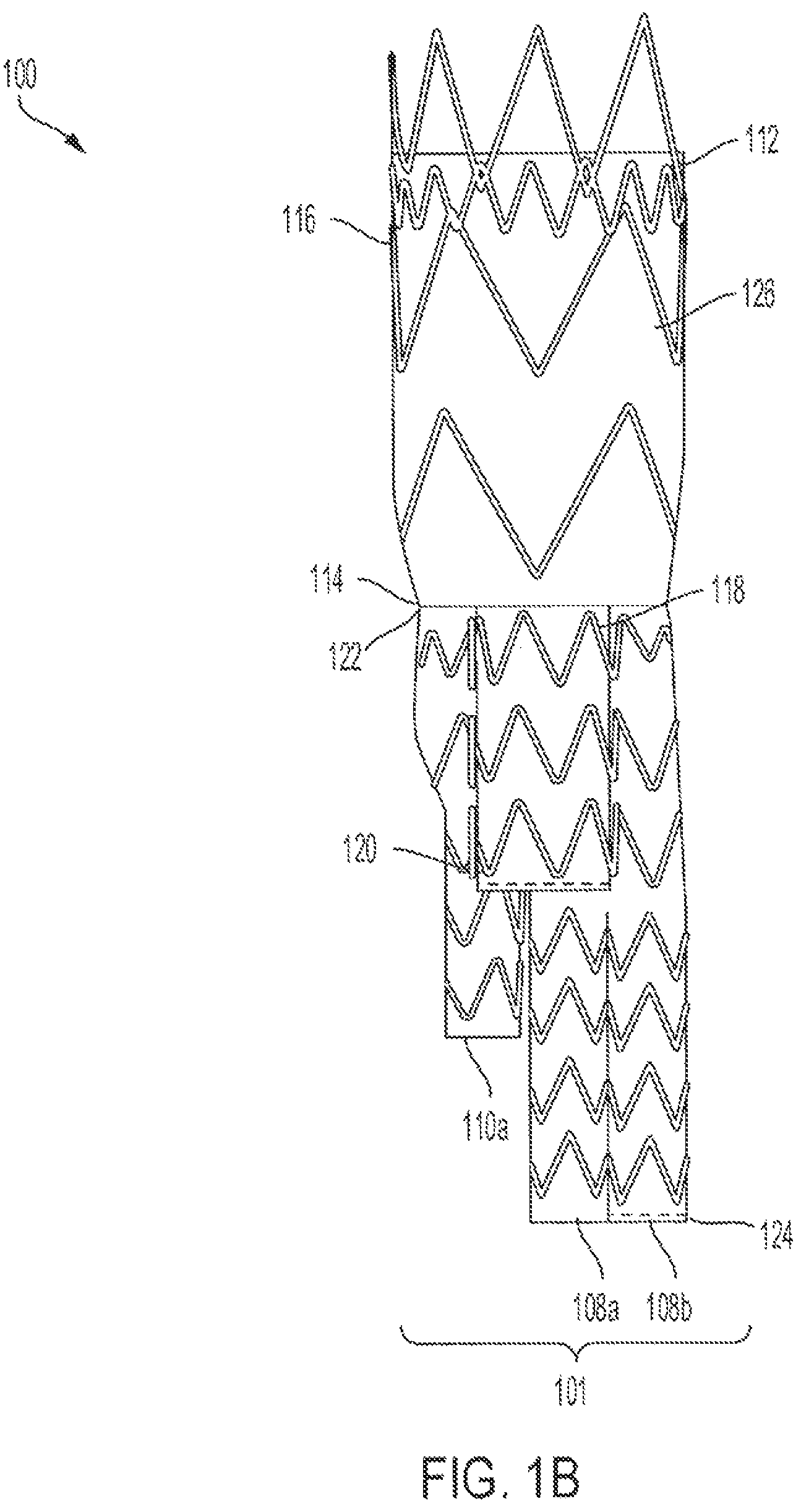 Patent US12090070 Figure 2 – Re-location of main body bypass branch on multi-branched stent graft
