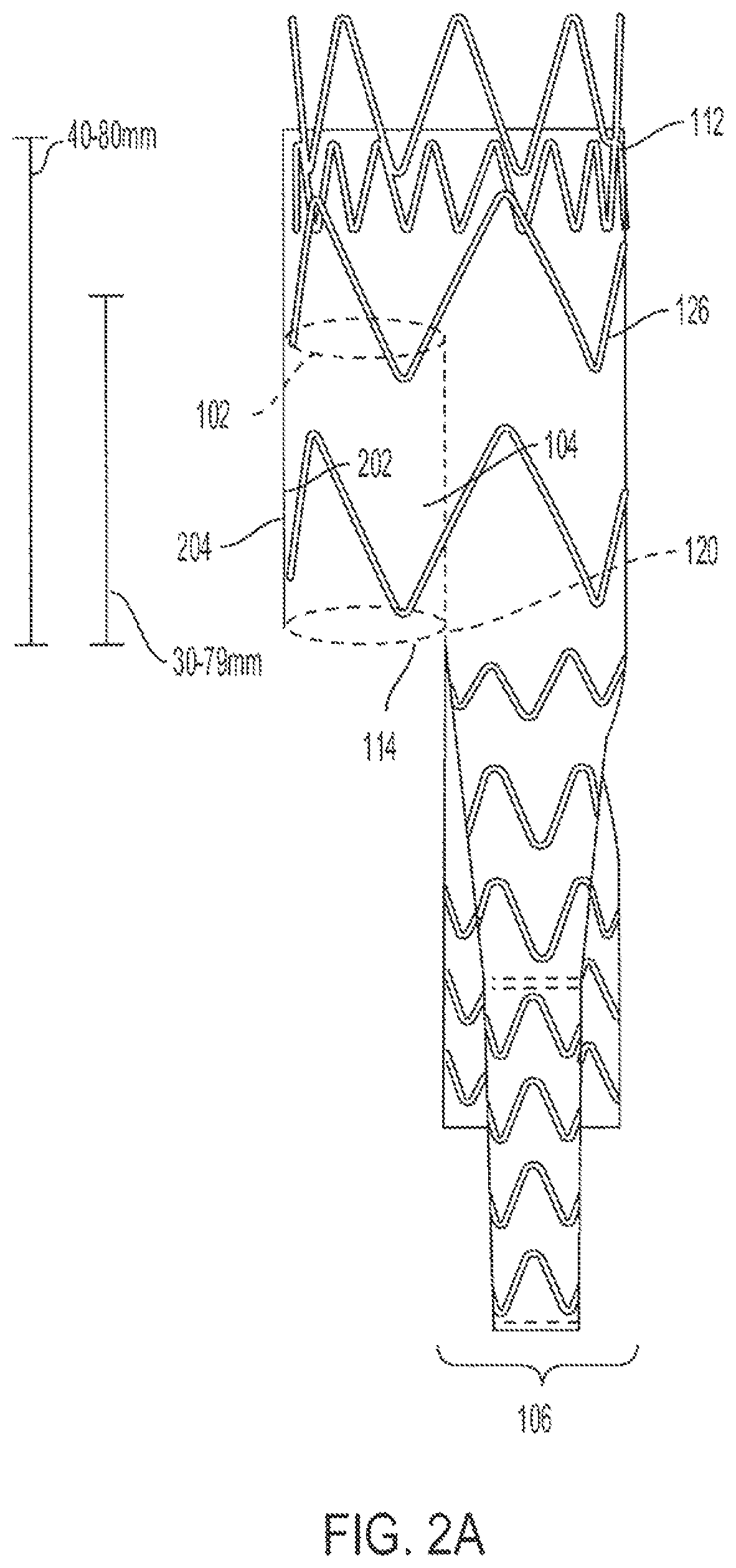 Patent US12090070 Figure 3 – Re-location of main body bypass branch on multi-branched stent graft