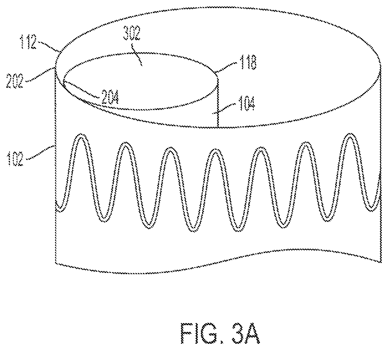 Patent US12090070 Figure 5 – Re-location of main body bypass branch on multi-branched stent graft