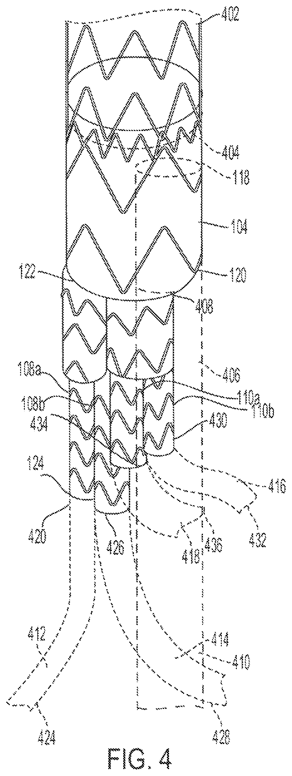 Patent US12090070 Figure 8 – Re-location of main body bypass branch on multi-branched stent graft