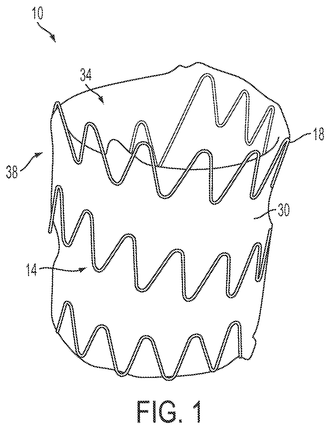 Patent US12090071 Figure 1 – Vascular prosthetic assemblies