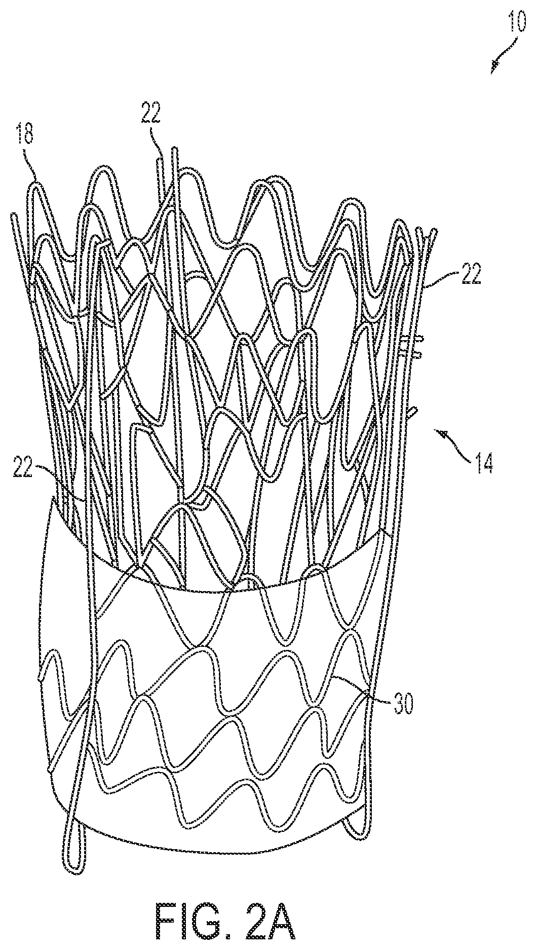 Patent US12090071 Figure 2 – Vascular prosthetic assemblies