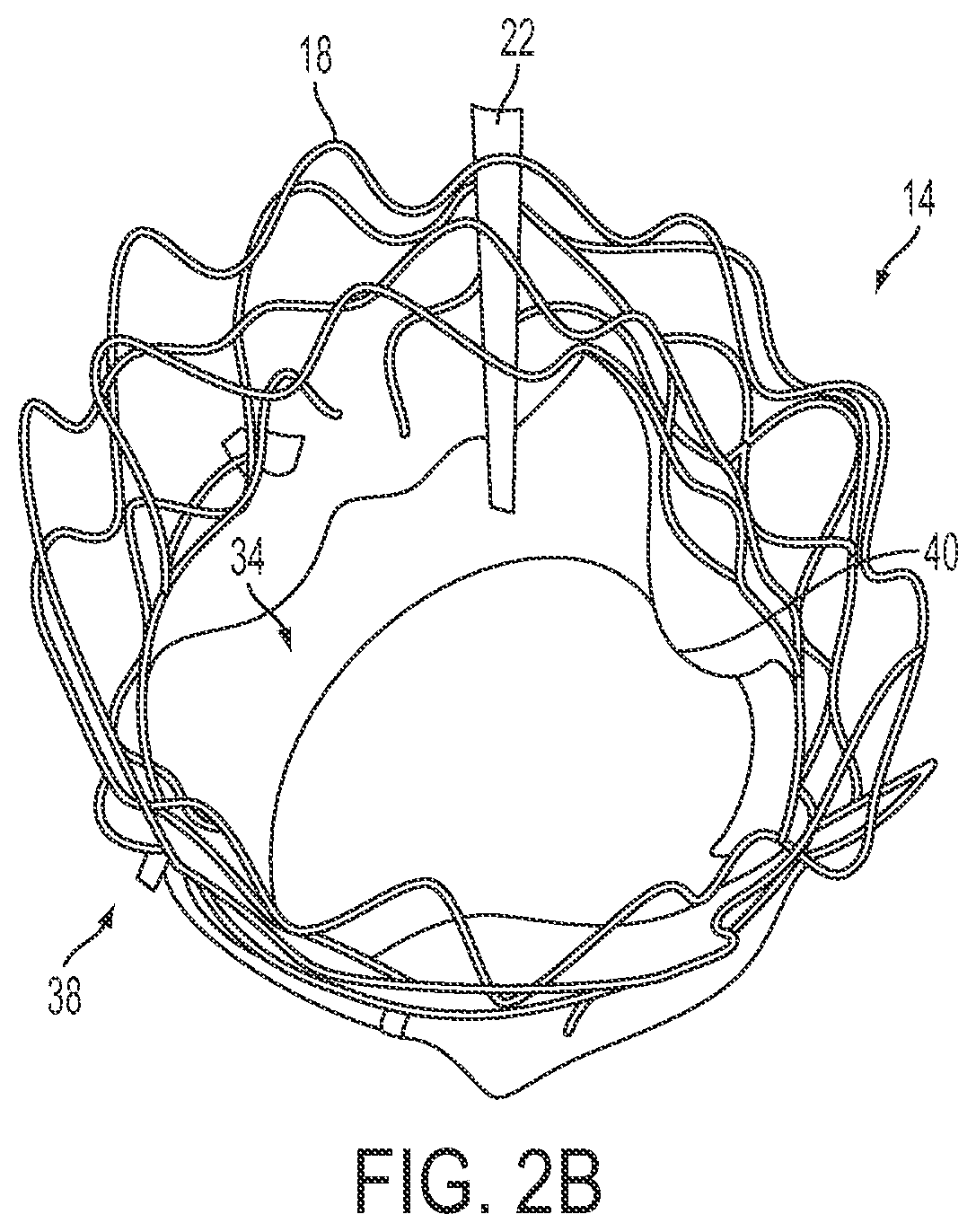 Patent US12090071 Figure 3 – Vascular prosthetic assemblies