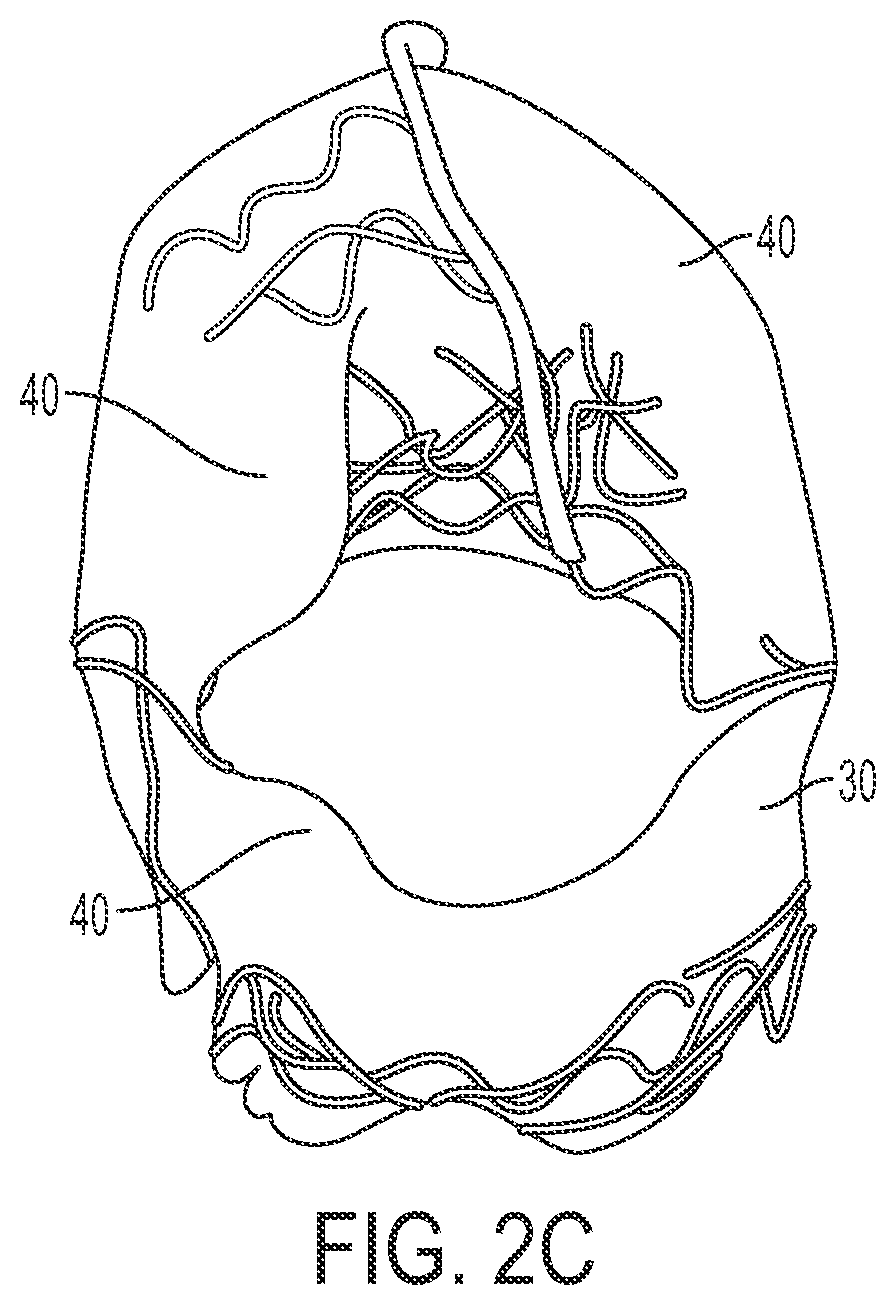 Patent US12090071 Figure 4 – Vascular prosthetic assemblies