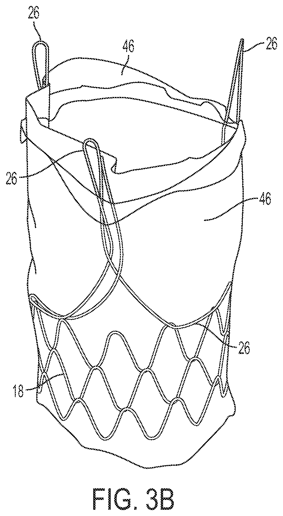 Patent US12090071 Figure 7 – Vascular prosthetic assemblies