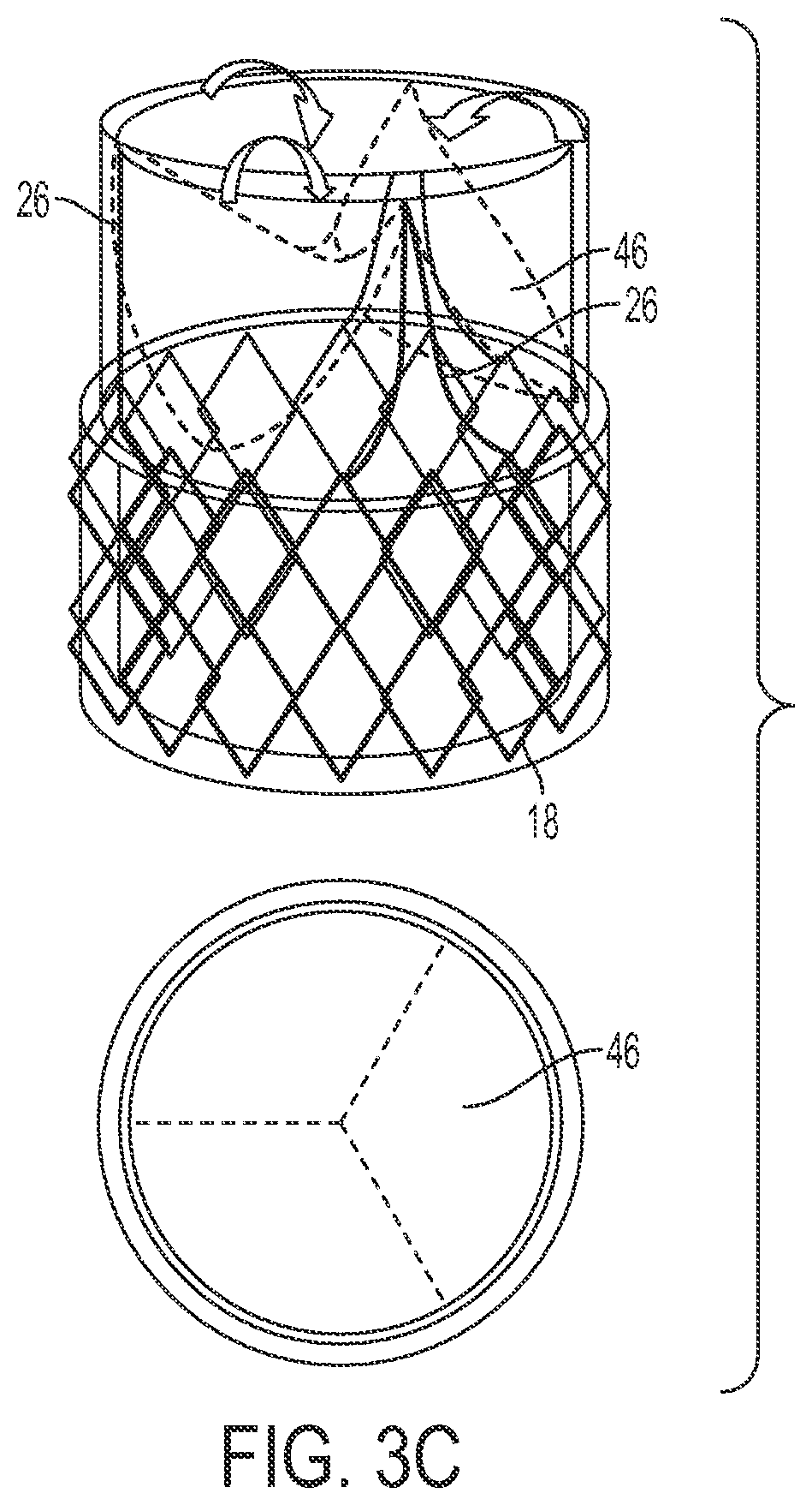 Patent US12090071 Figure 8 – Vascular prosthetic assemblies