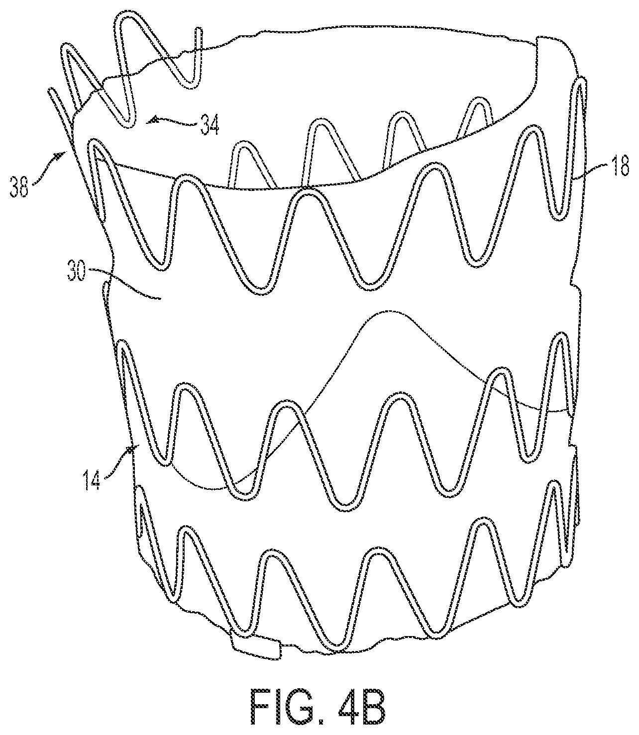 Patent US12090071 Figure 10 – Vascular prosthetic assemblies