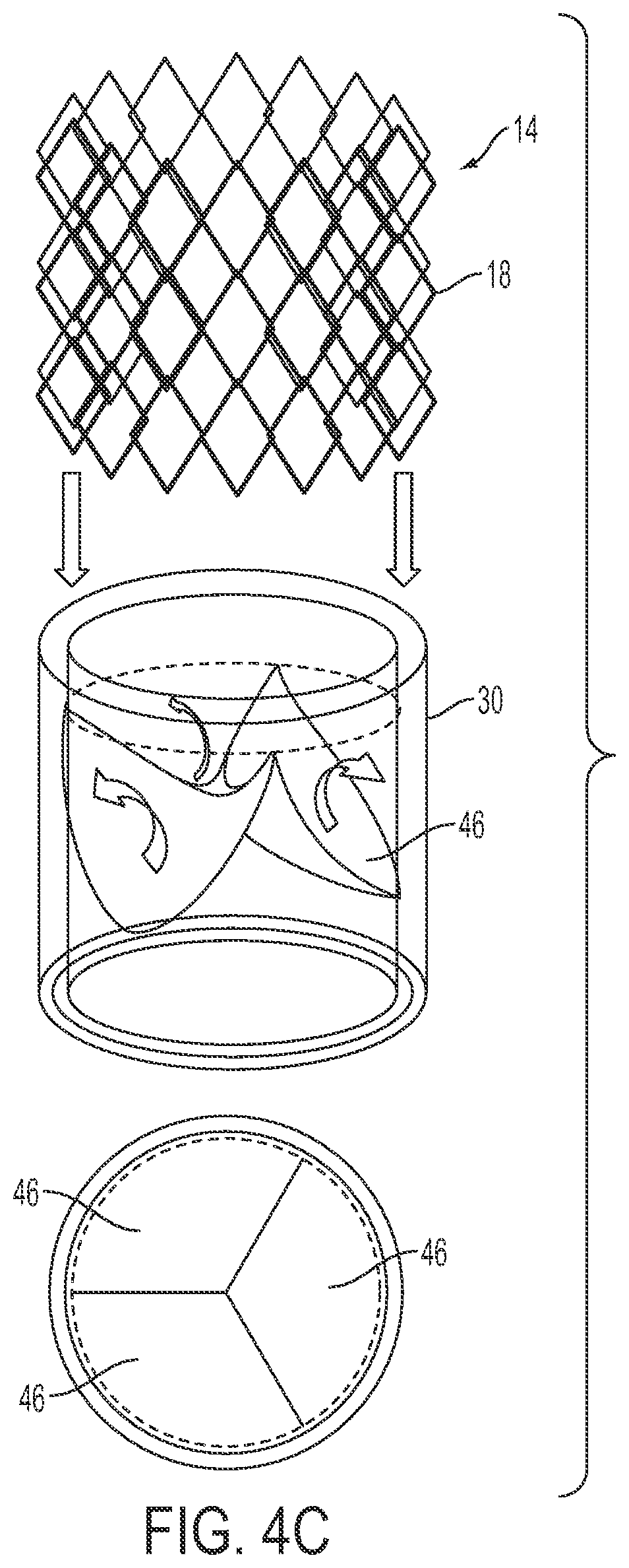 Patent US12090071 Figure 11 – Vascular prosthetic assemblies