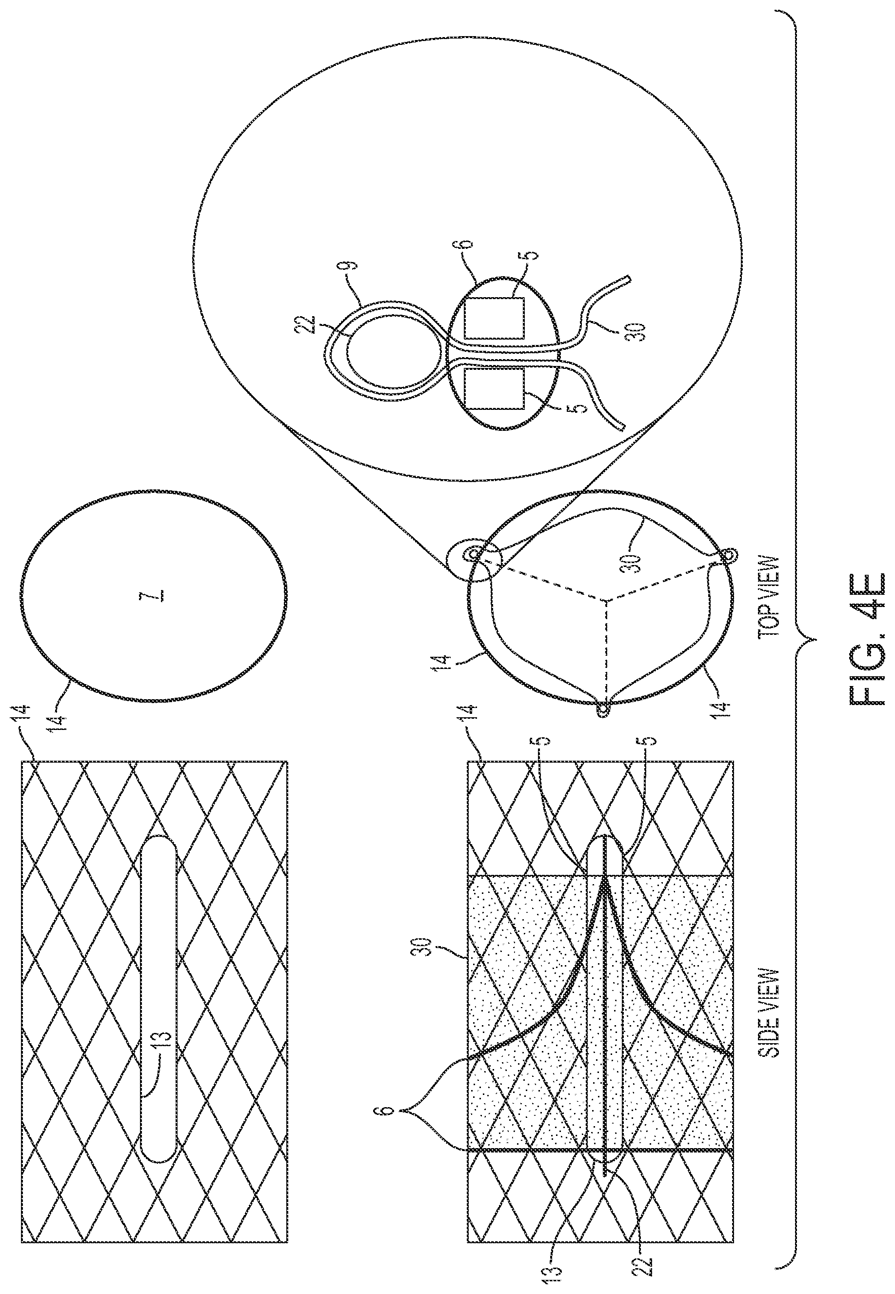 Patent US12090071 Figure 13 – Vascular prosthetic assemblies