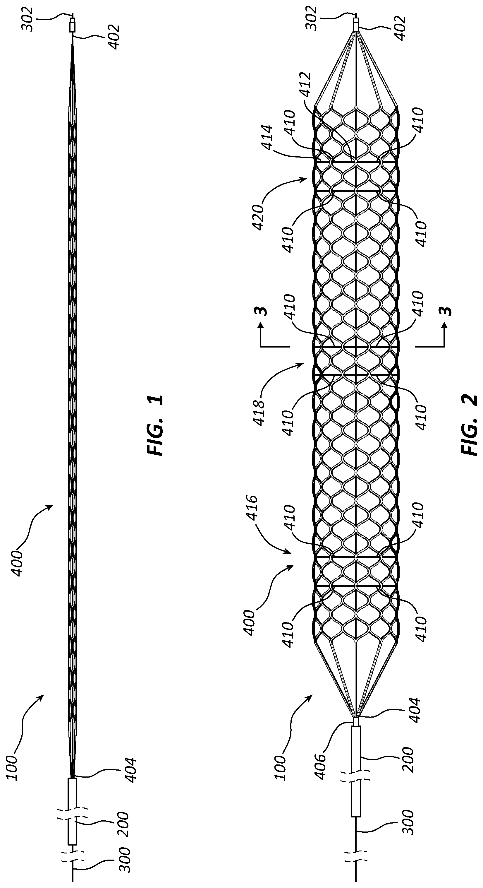 Patent US12090072 Figure 1 – Systems and methods for delivery retrievable stents