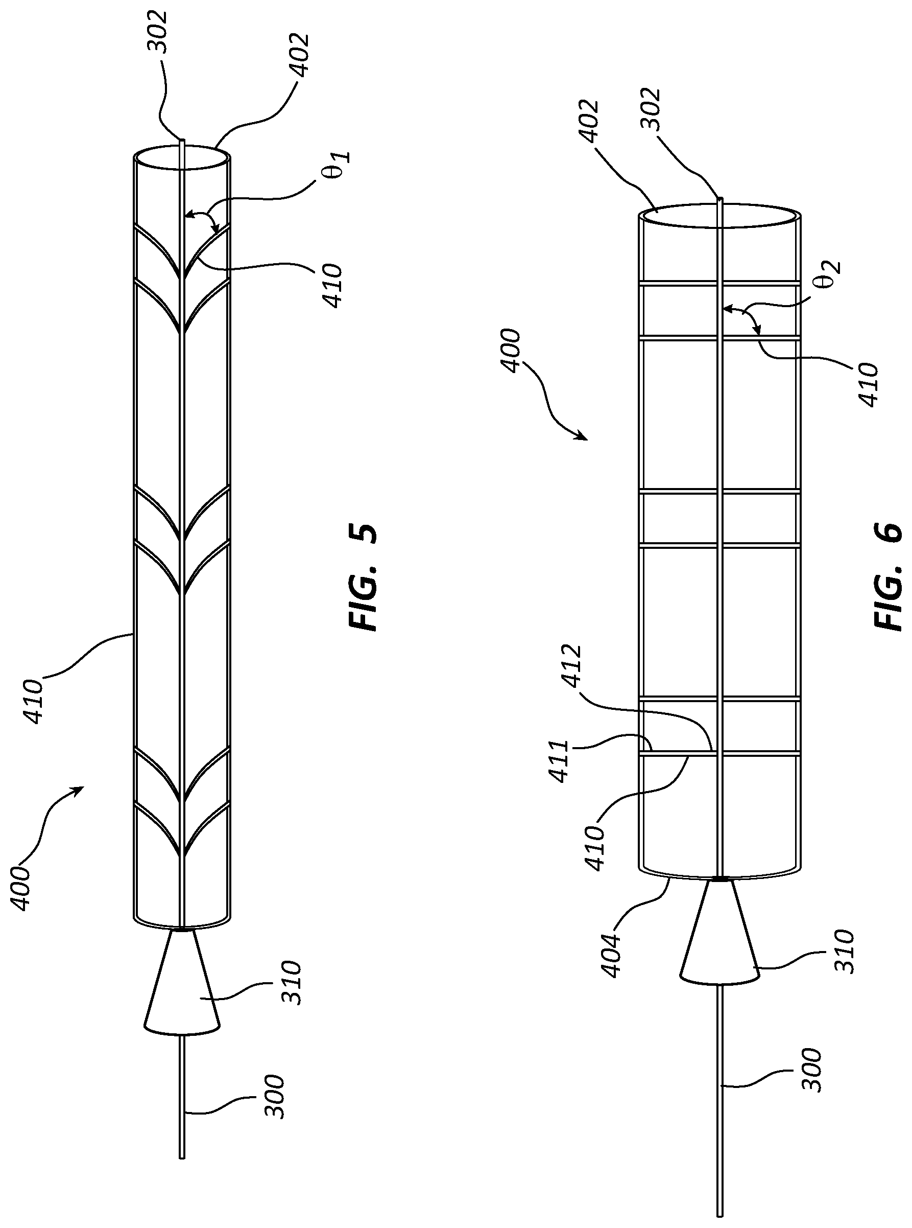Patent US12090072 Figure 4 – Systems and methods for delivery retrievable stents