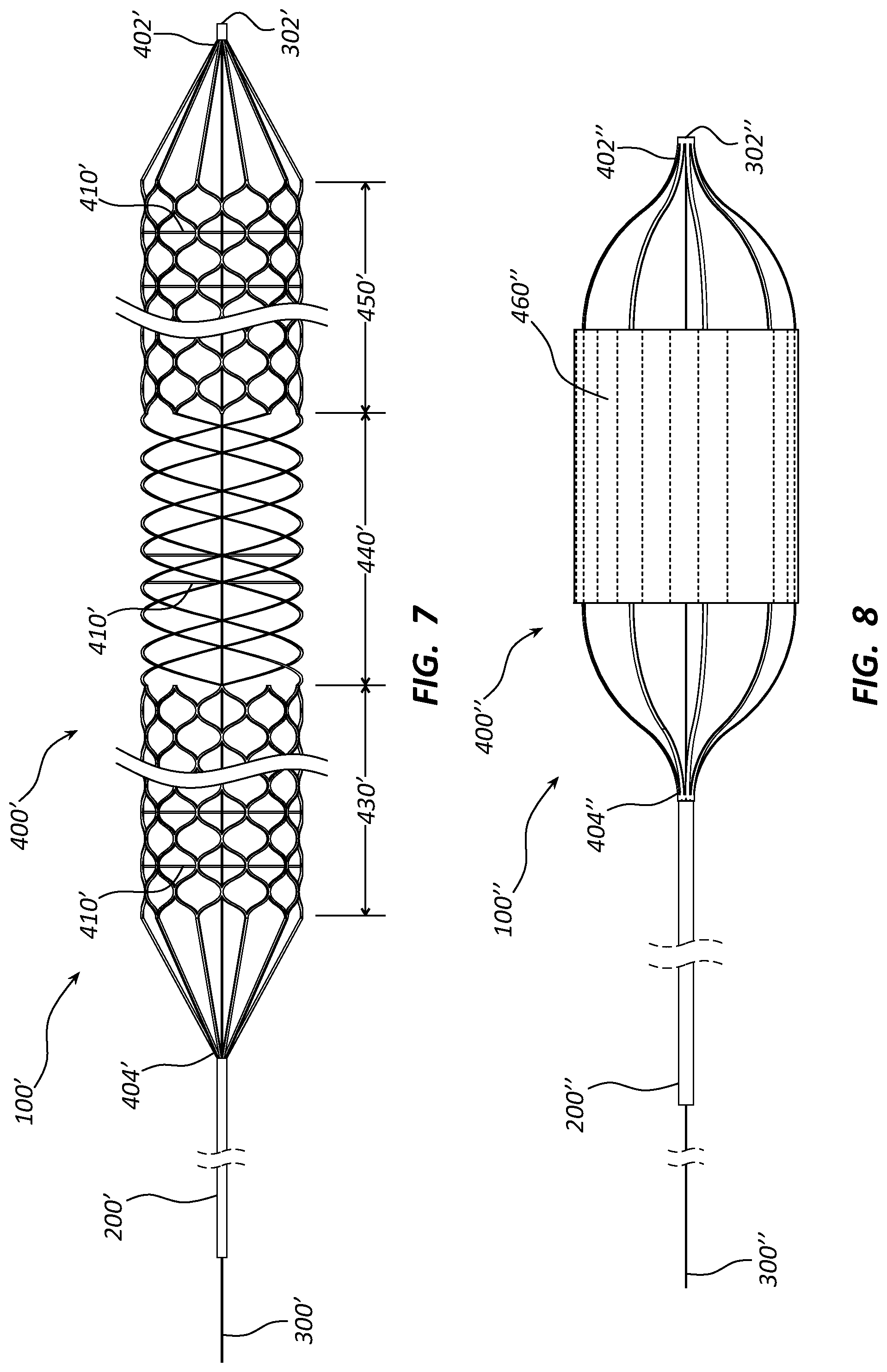 Patent US12090072 Figure 5 – Systems and methods for delivery retrievable stents