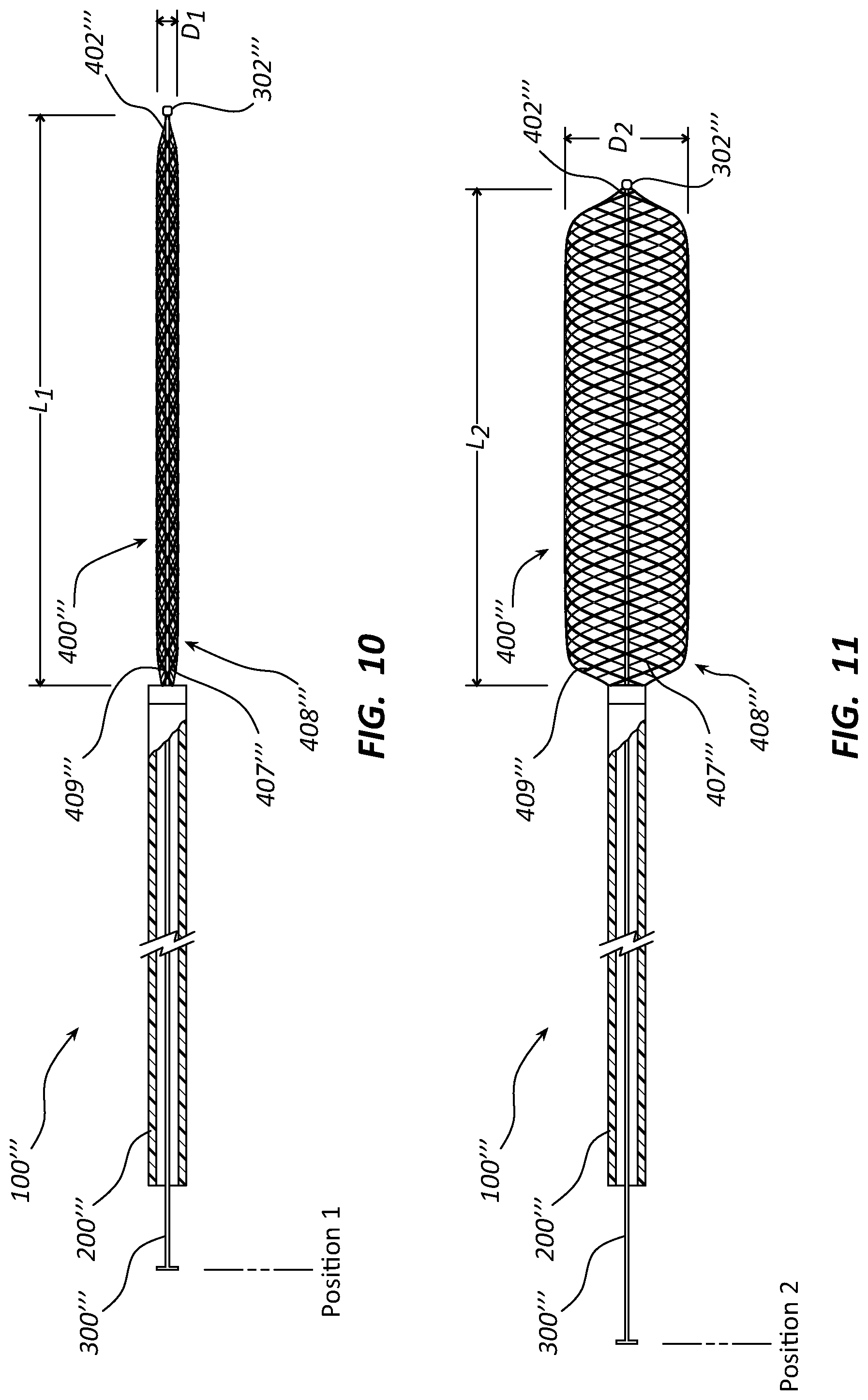 Patent US12090072 Figure 7 – Systems and methods for delivery retrievable stents