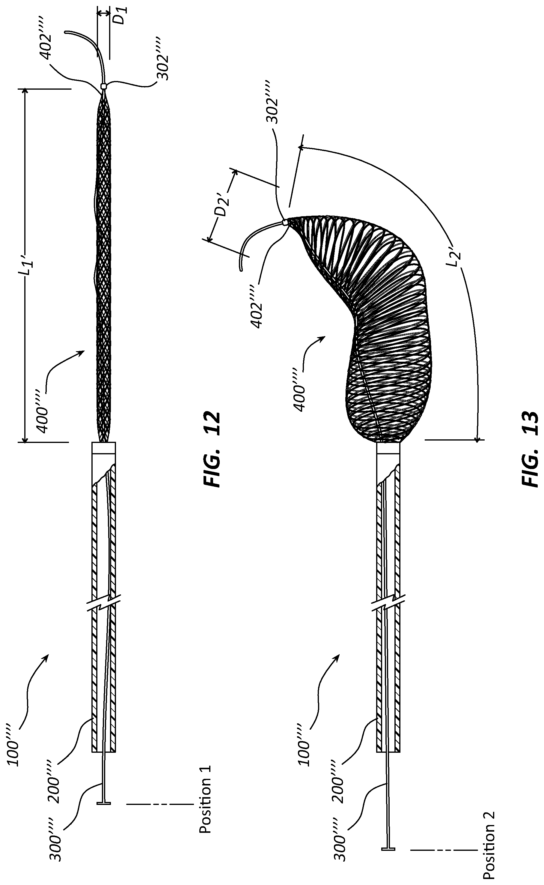 Patent US12090072 Figure 8 – Systems and methods for delivery retrievable stents
