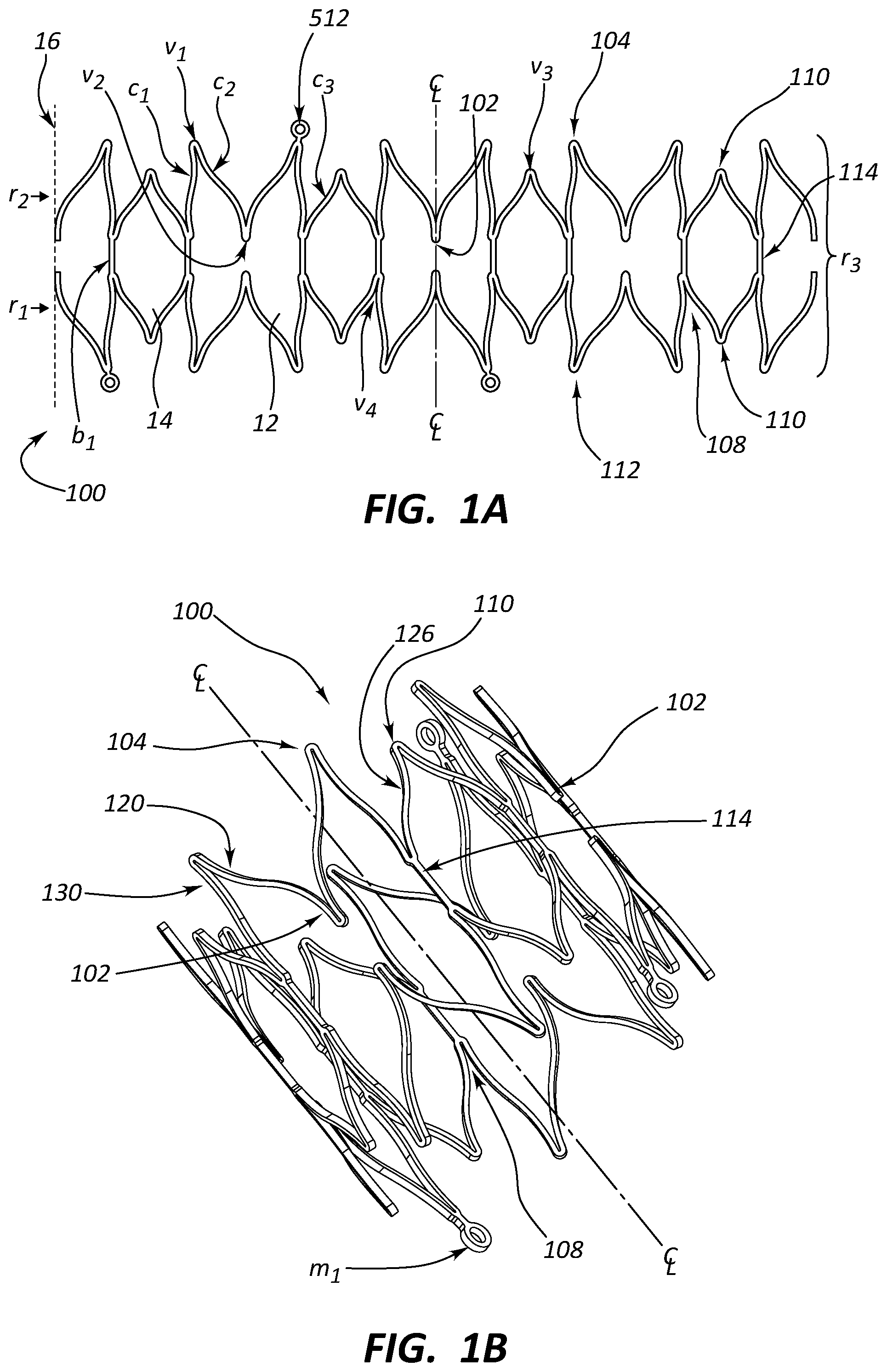 Patent US12090073 Figure 1 – Short stent