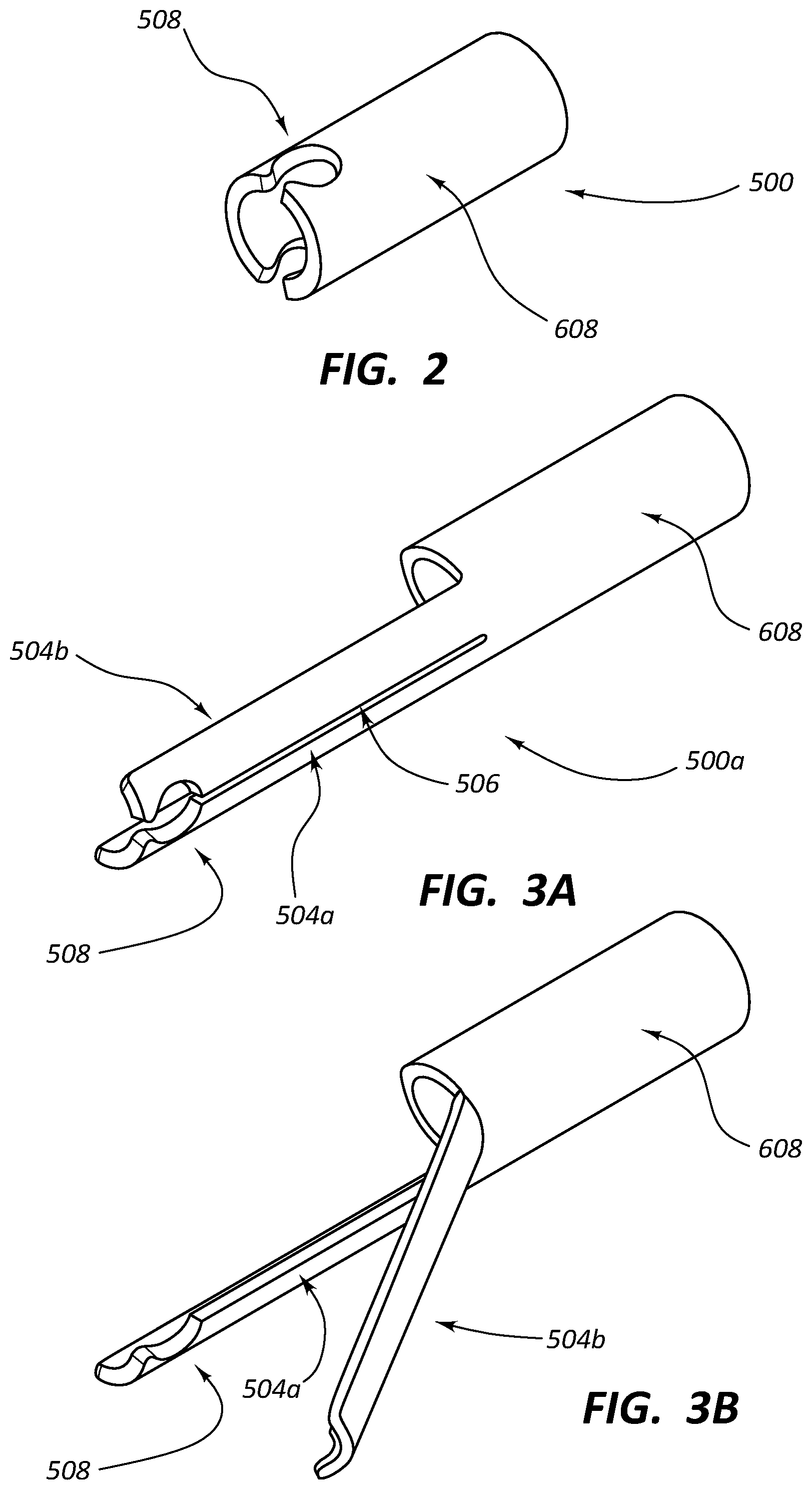 Patent US12090073 Figure 3 – Short stent