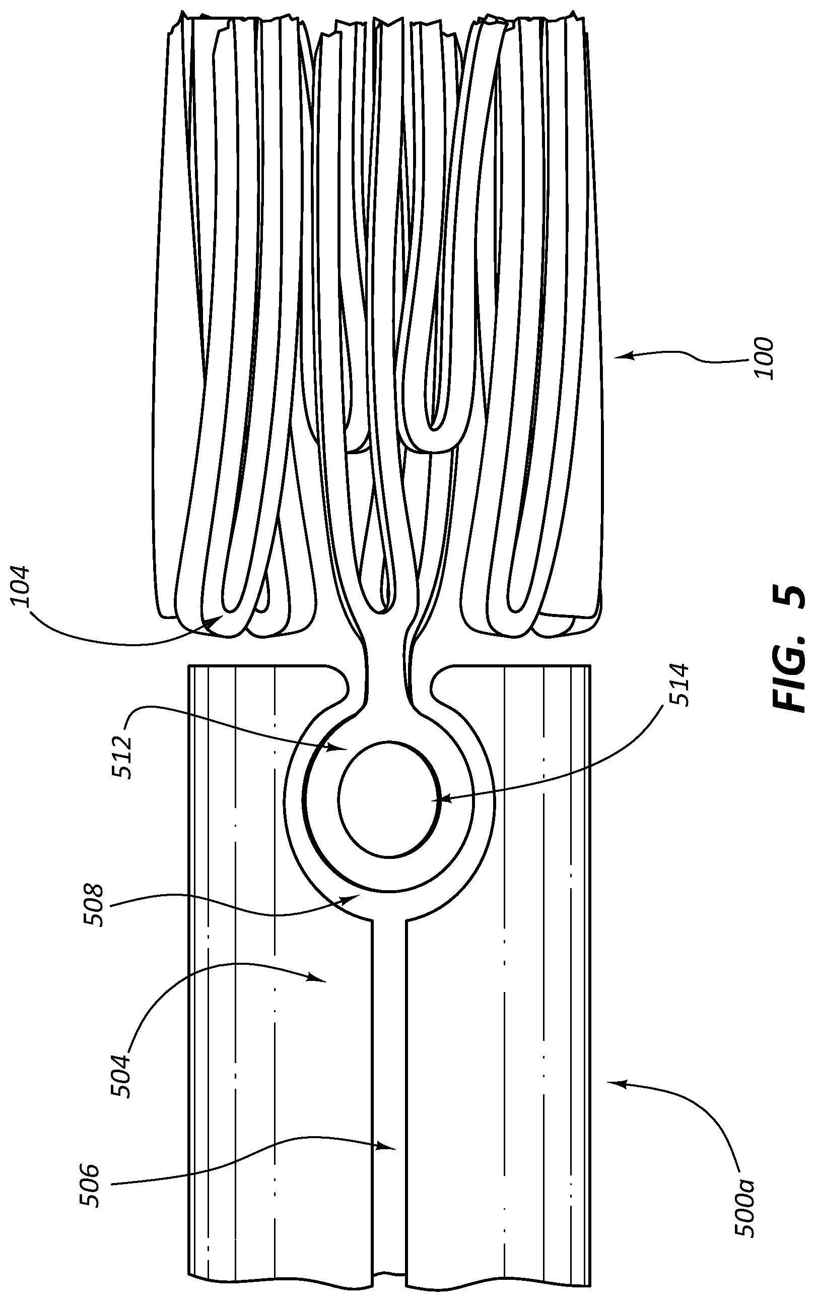 Patent US12090073 Figure 5 – Short stent