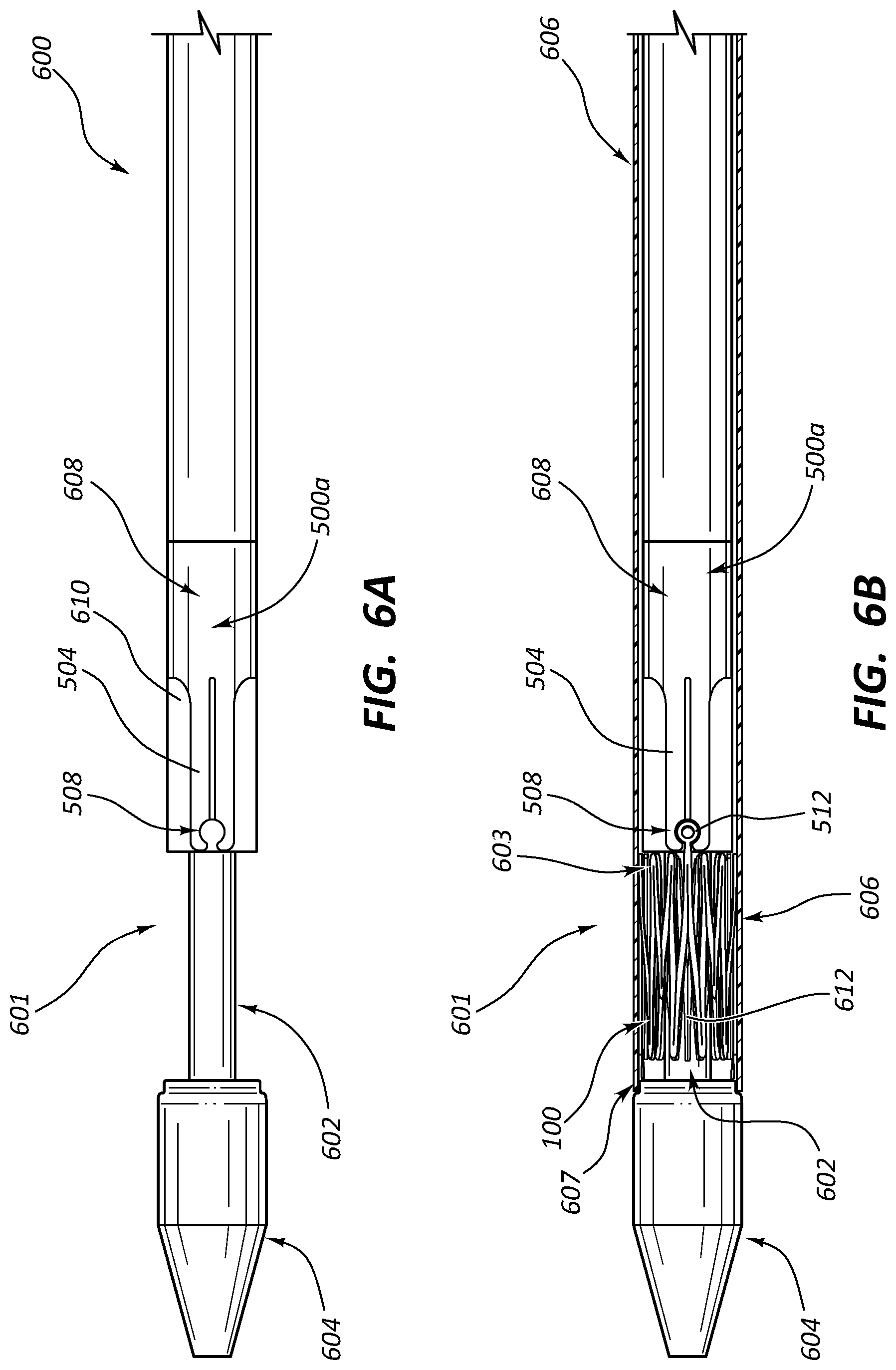 Patent US12090073 Figure 6 – Short stent