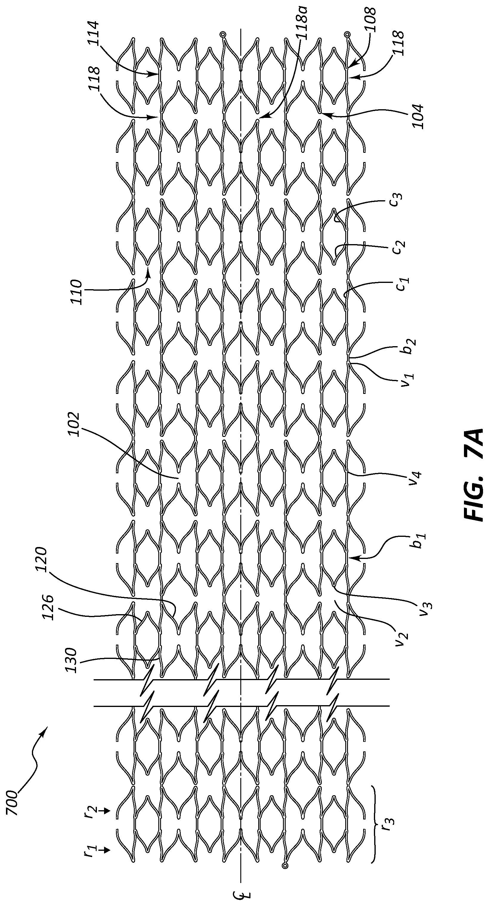 Patent US12090073 Figure 7 – Short stent