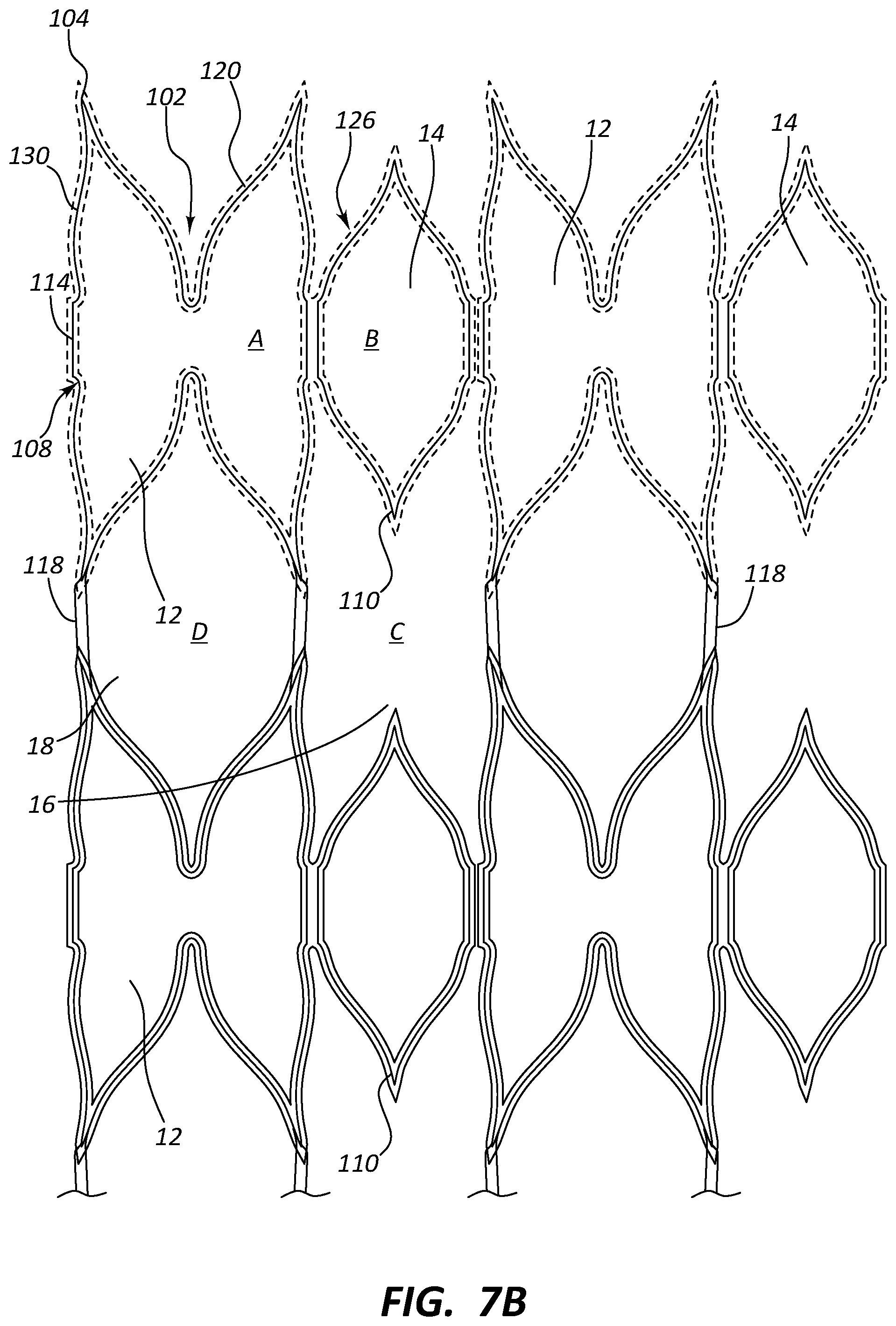 Patent US12090073 Figure 8 – Short stent