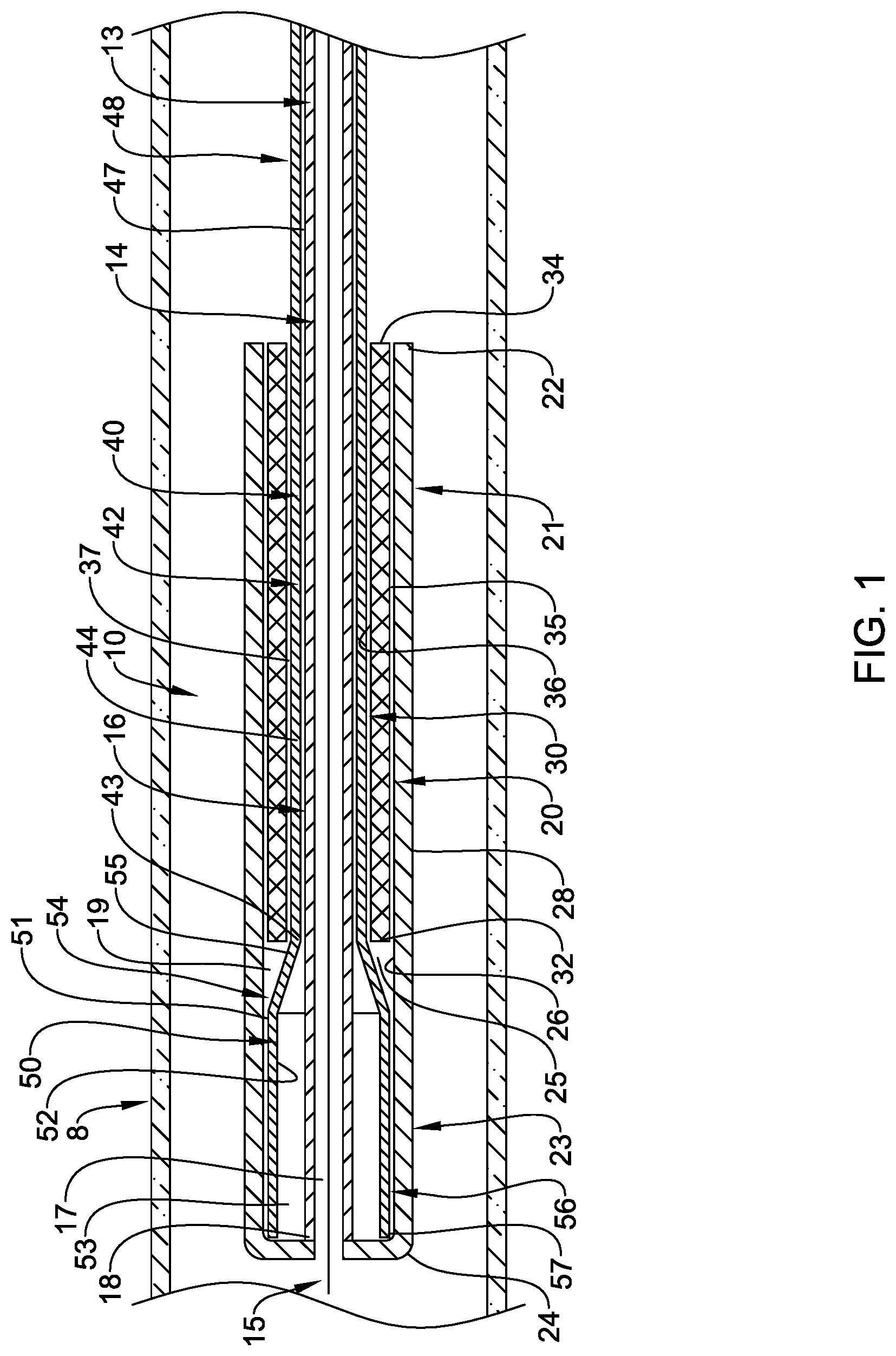 Patent US12090074 Figure 1 – Stent delivery systems