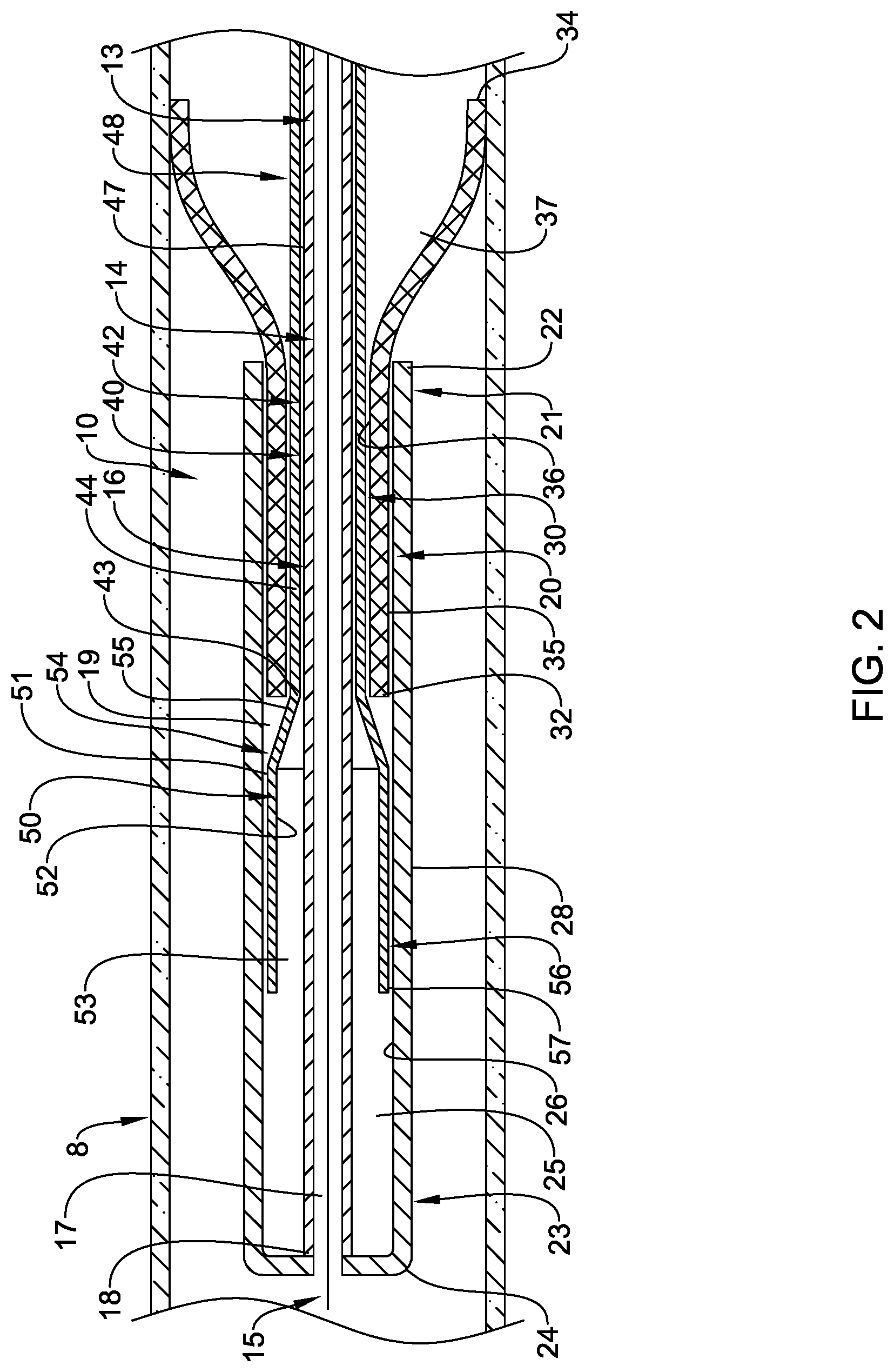 Patent US12090074 Figure 2 – Stent delivery systems