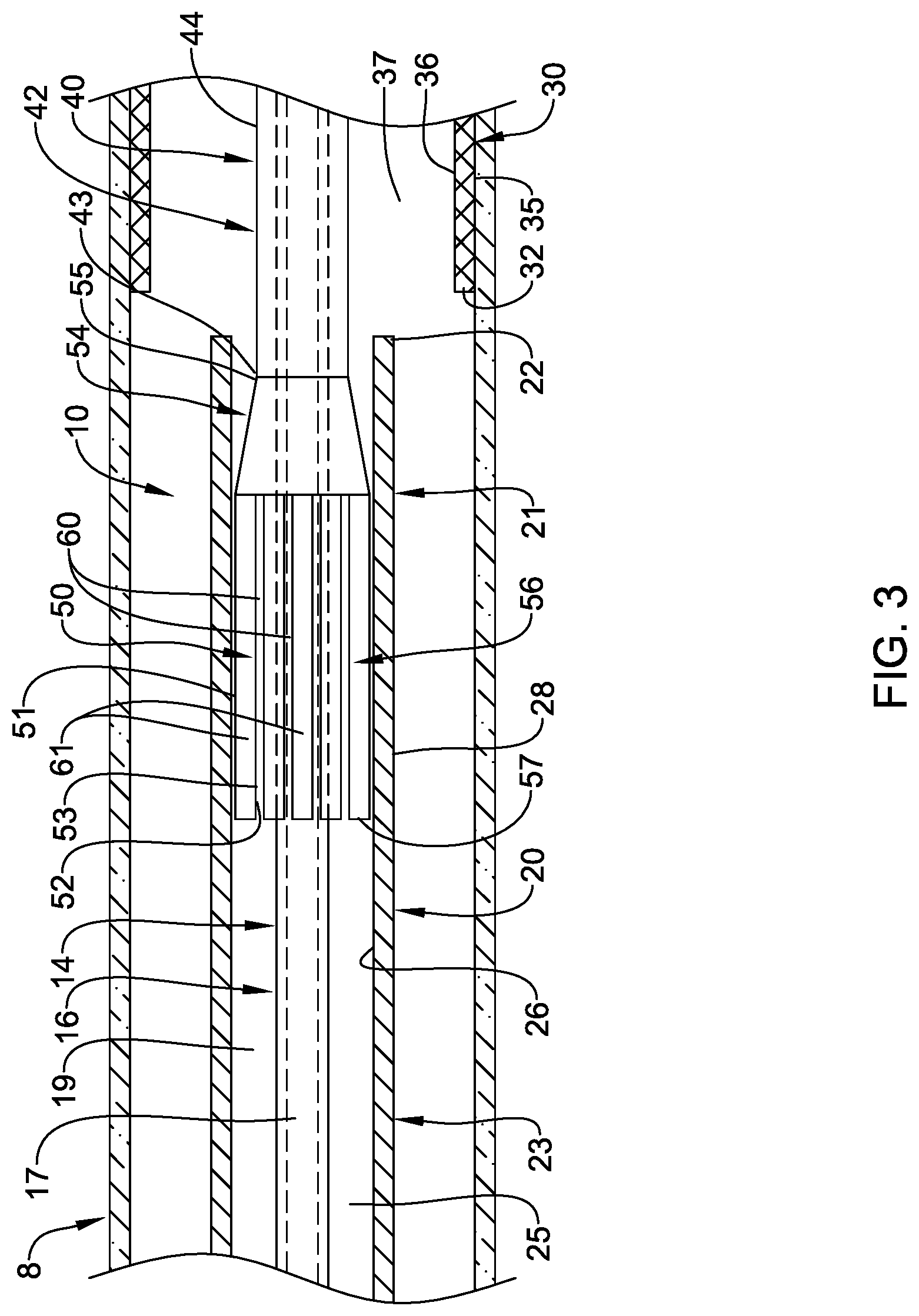 Patent US12090074 Figure 3 – Stent delivery systems
