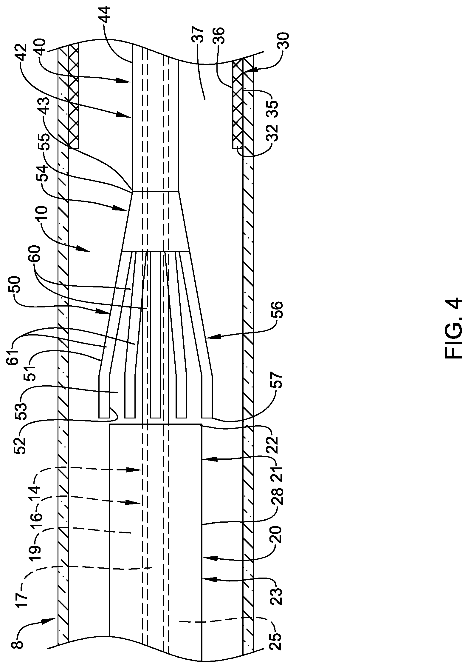 Patent US12090074 Figure 4 – Stent delivery systems