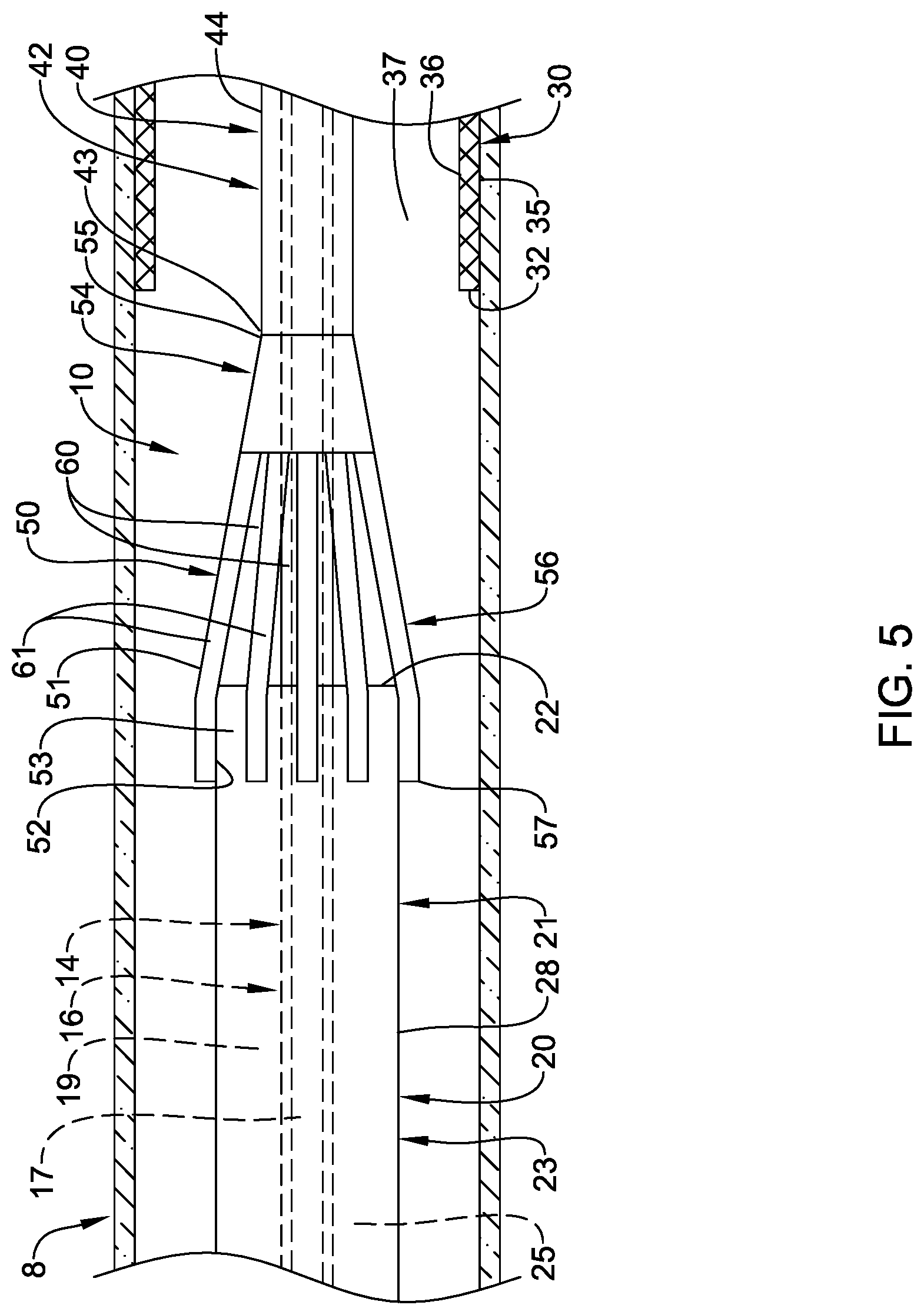 Patent US12090074 Figure 5 – Stent delivery systems