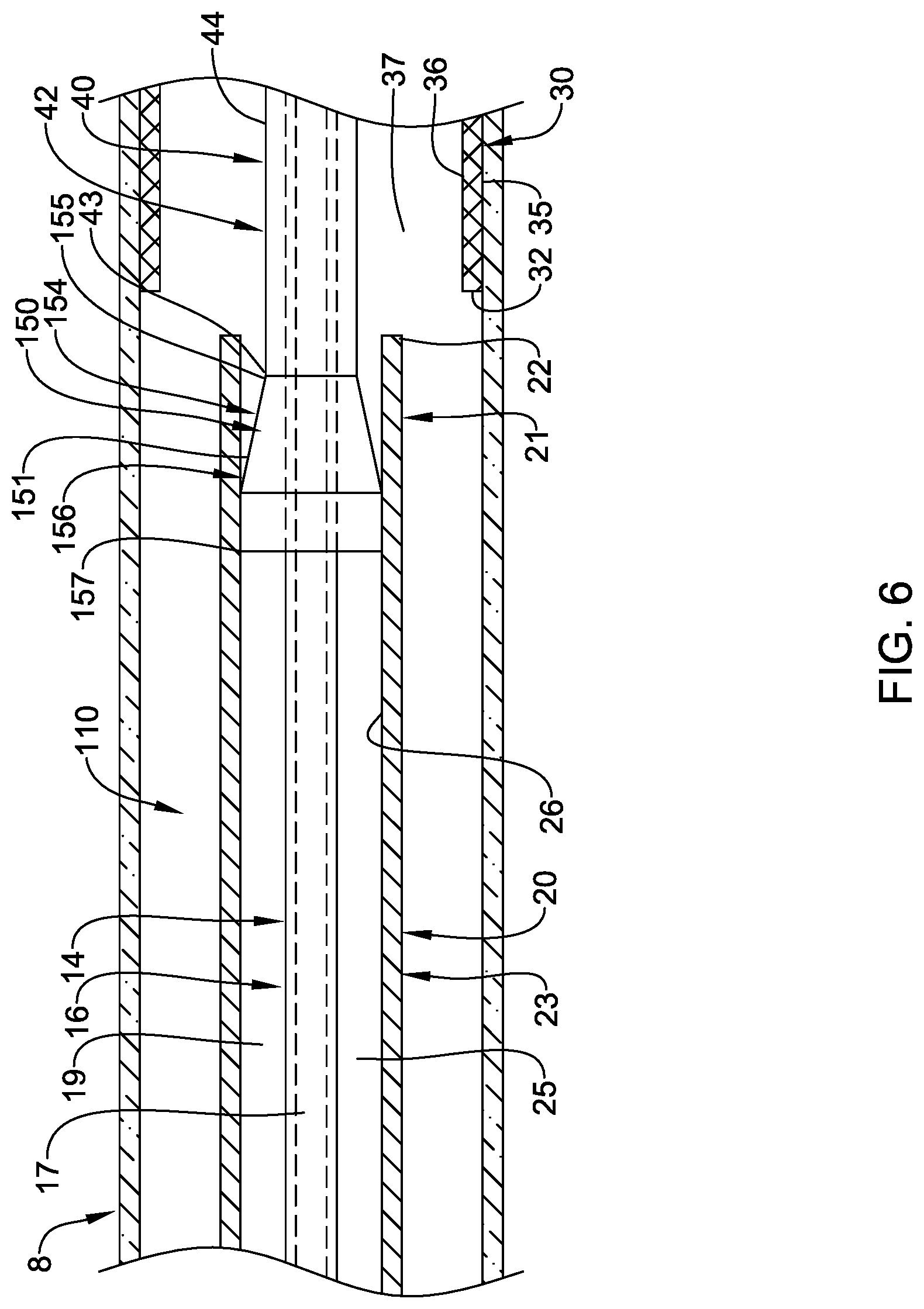 Patent US12090074 Figure 6 – Stent delivery systems